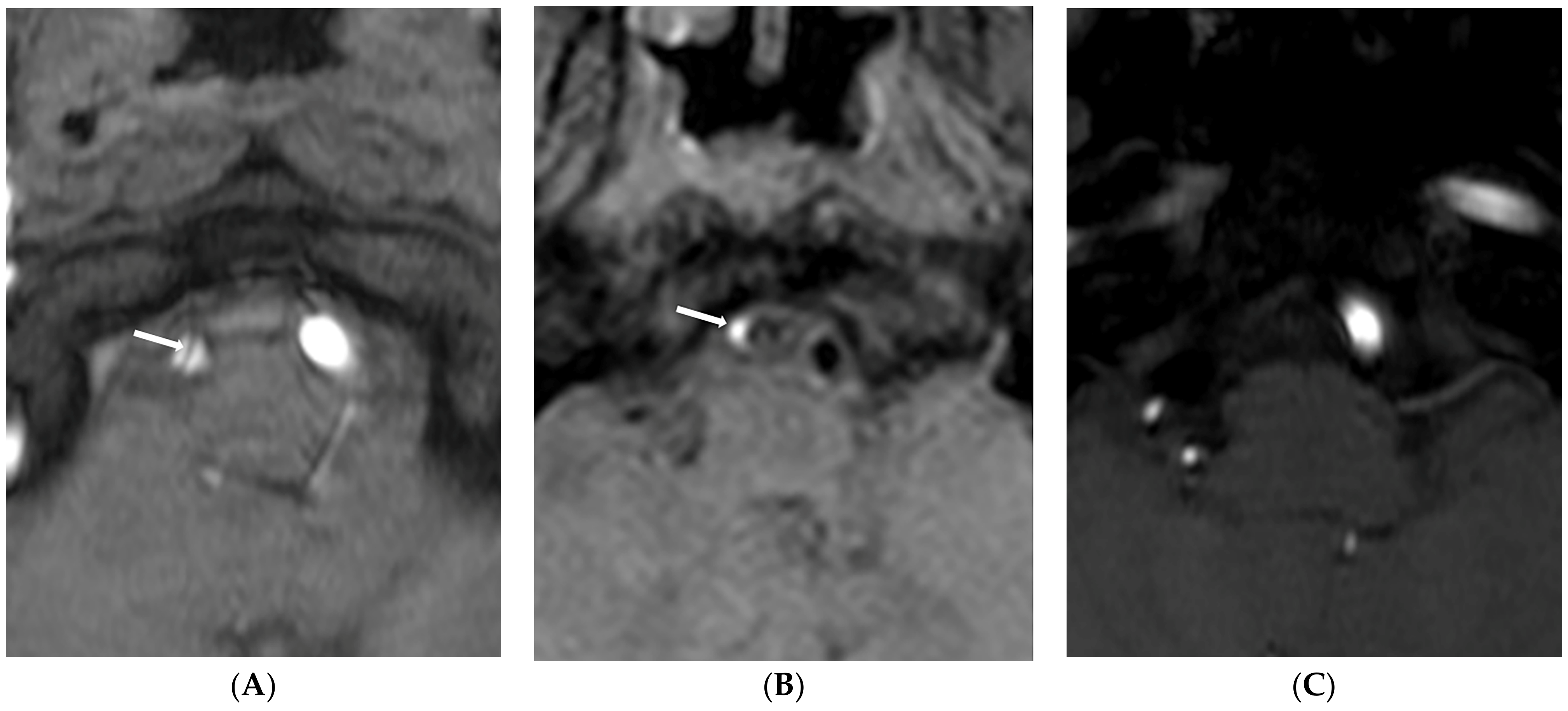 Diagnostics 13 03585 g003