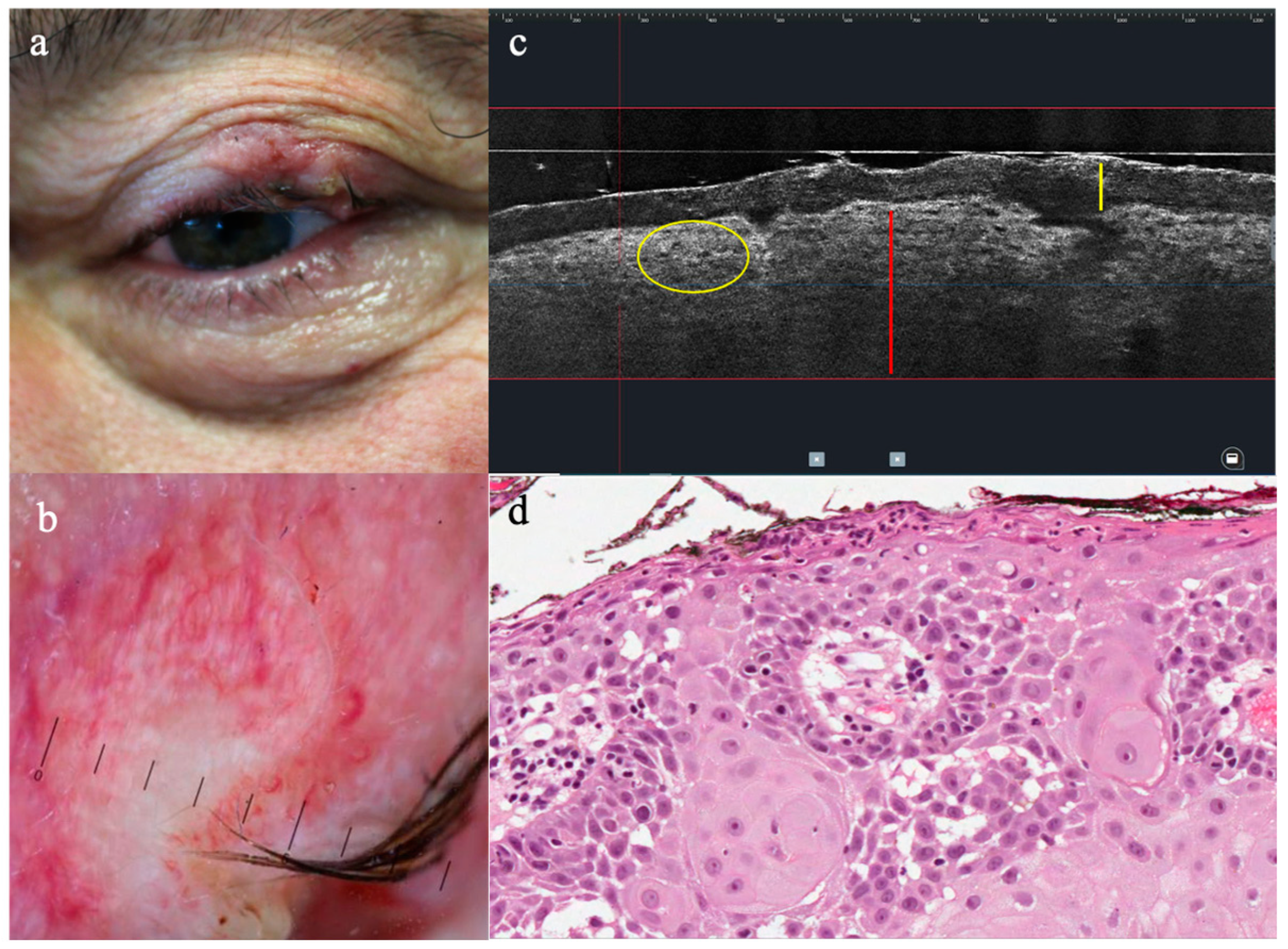 Diagnostics 13 03590 g003 Diagnostics 13 03590 g003