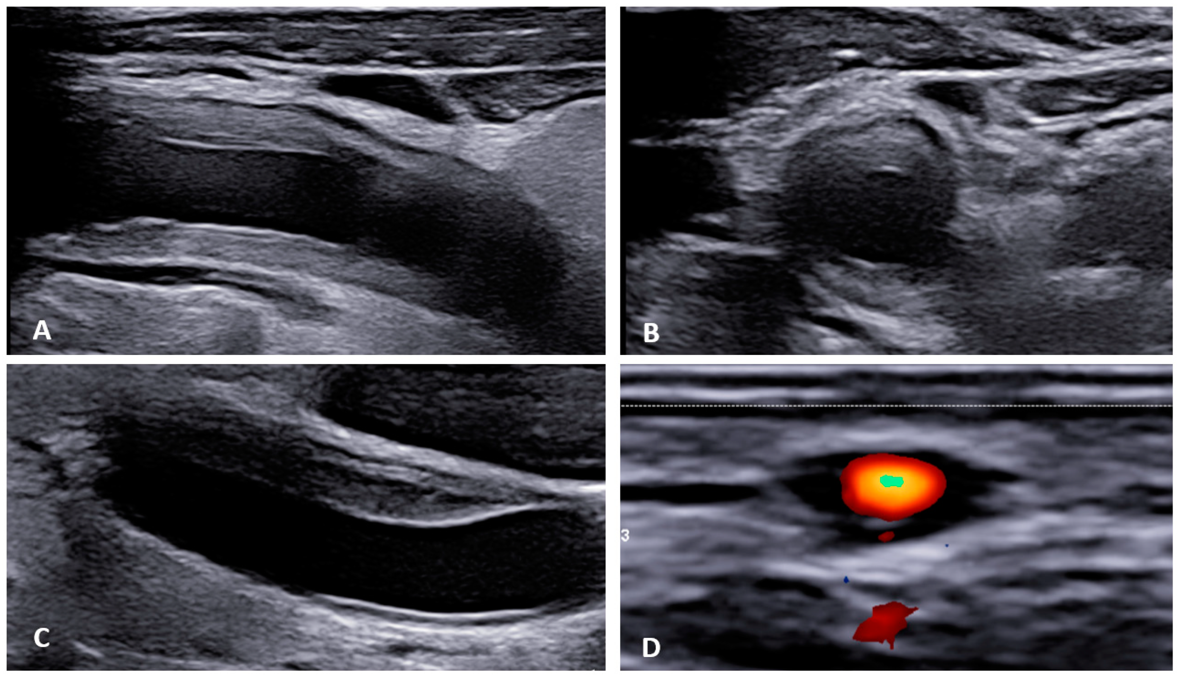 Diagnostics 13 03603 g002 Diagnostics 13 03603 g002