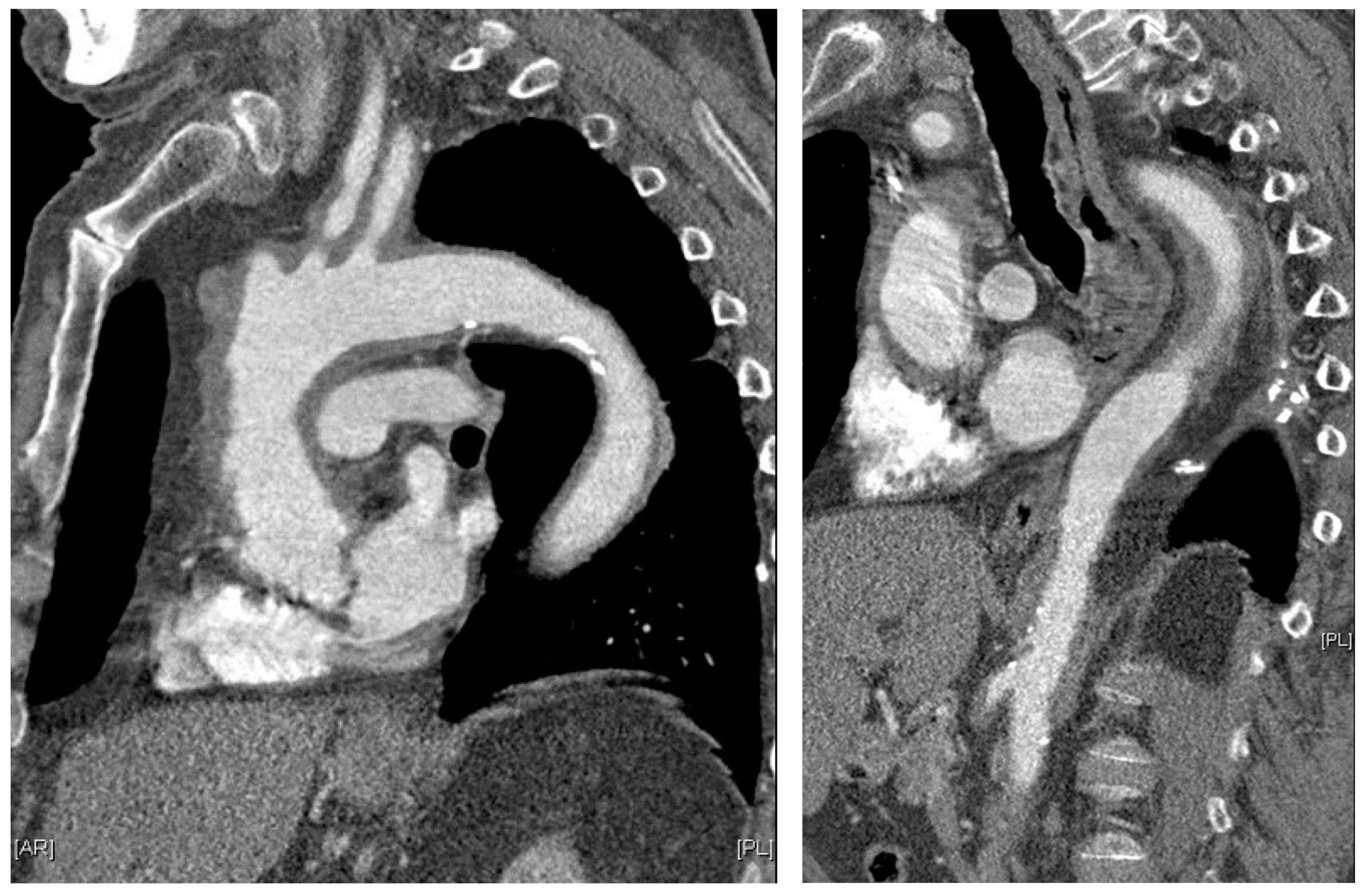 Diagnostics 13 03603 g003 Diagnostics 13 03603 g003