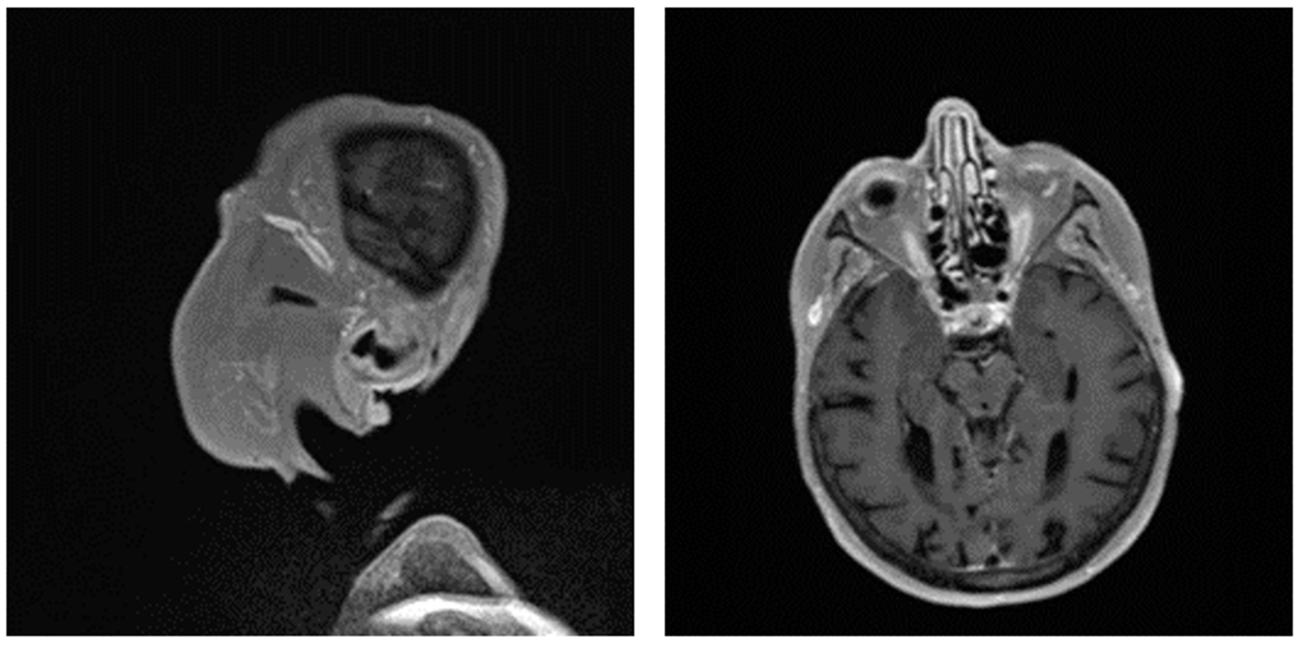 Diagnostics 13 03603 g004 Diagnostics 13 03603 g004