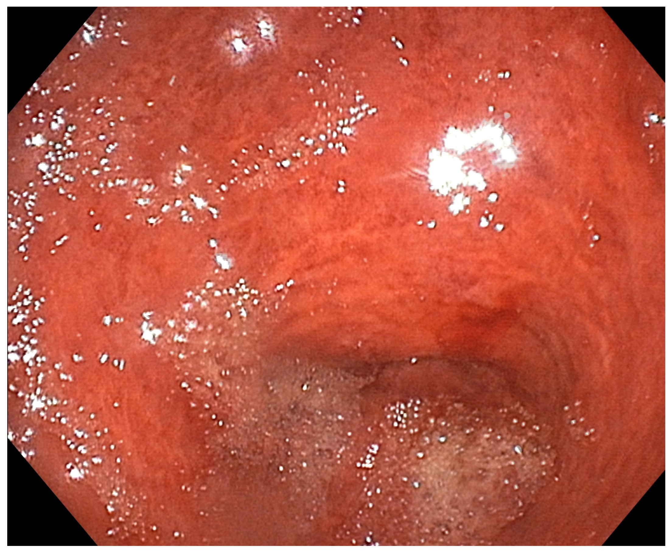 Diagnostics 13 03615 g004