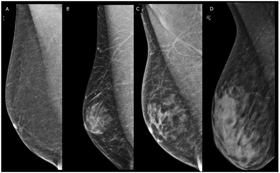 Male Breast: A Review of the Literature and Current State of