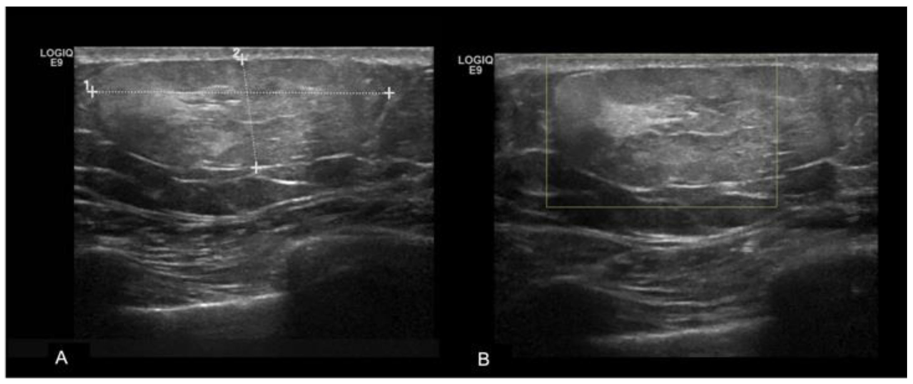Diagnostics 13 03620 g003 Diagnostics 13 03620 g003