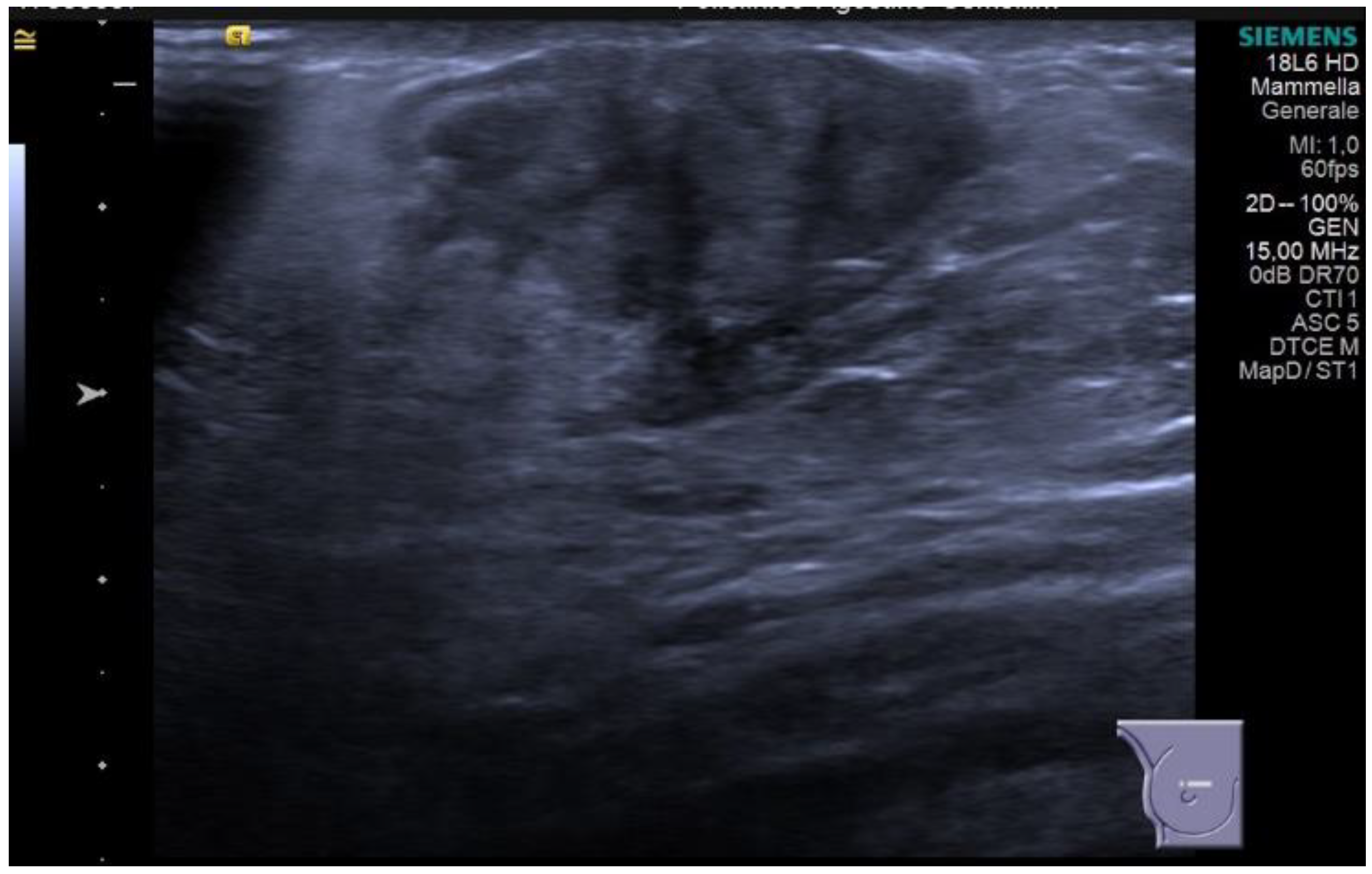 Diagnostics 13 03620 g005 Diagnostics 13 03620 g005