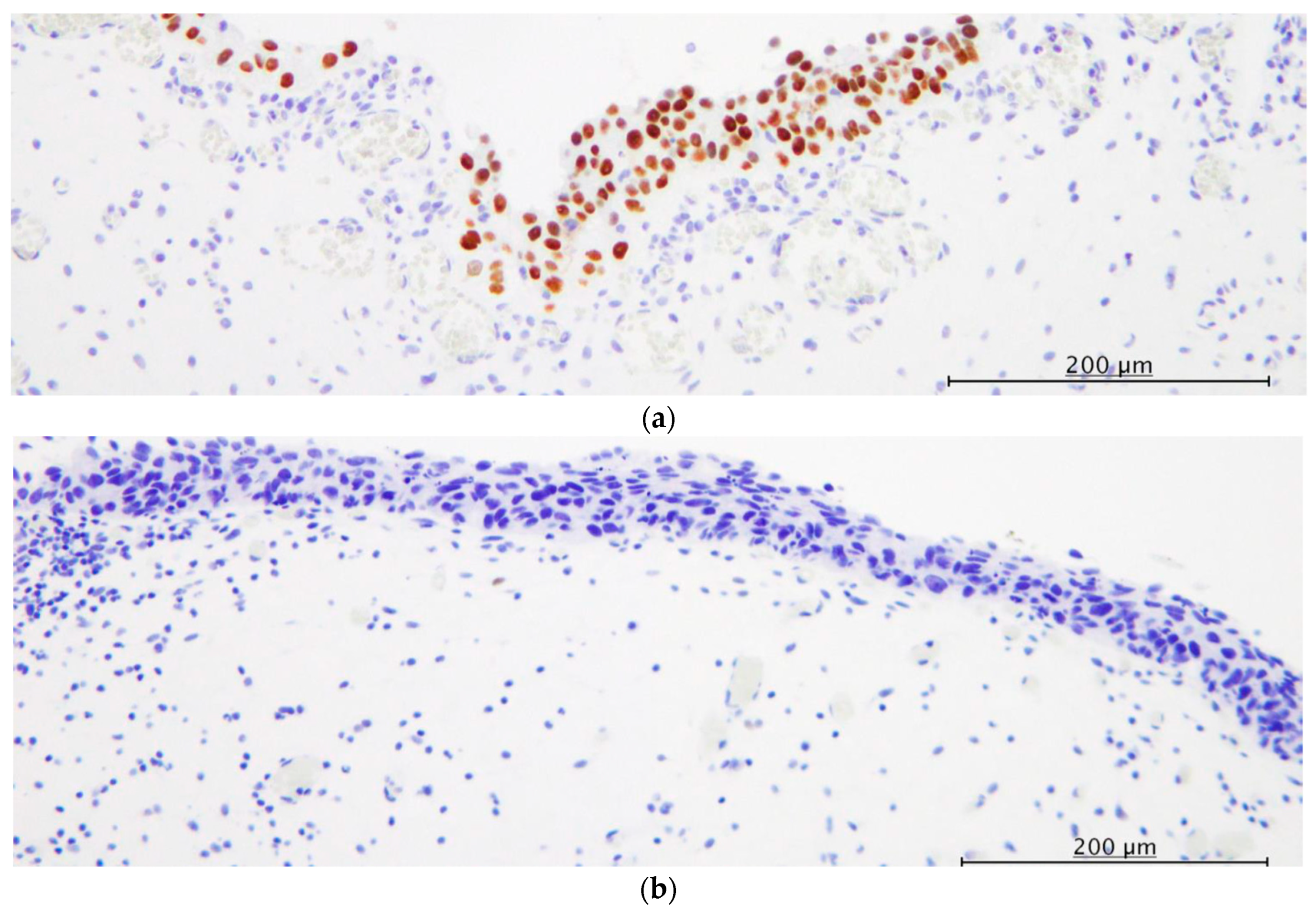 Diagnostics 13 03636 g003a
