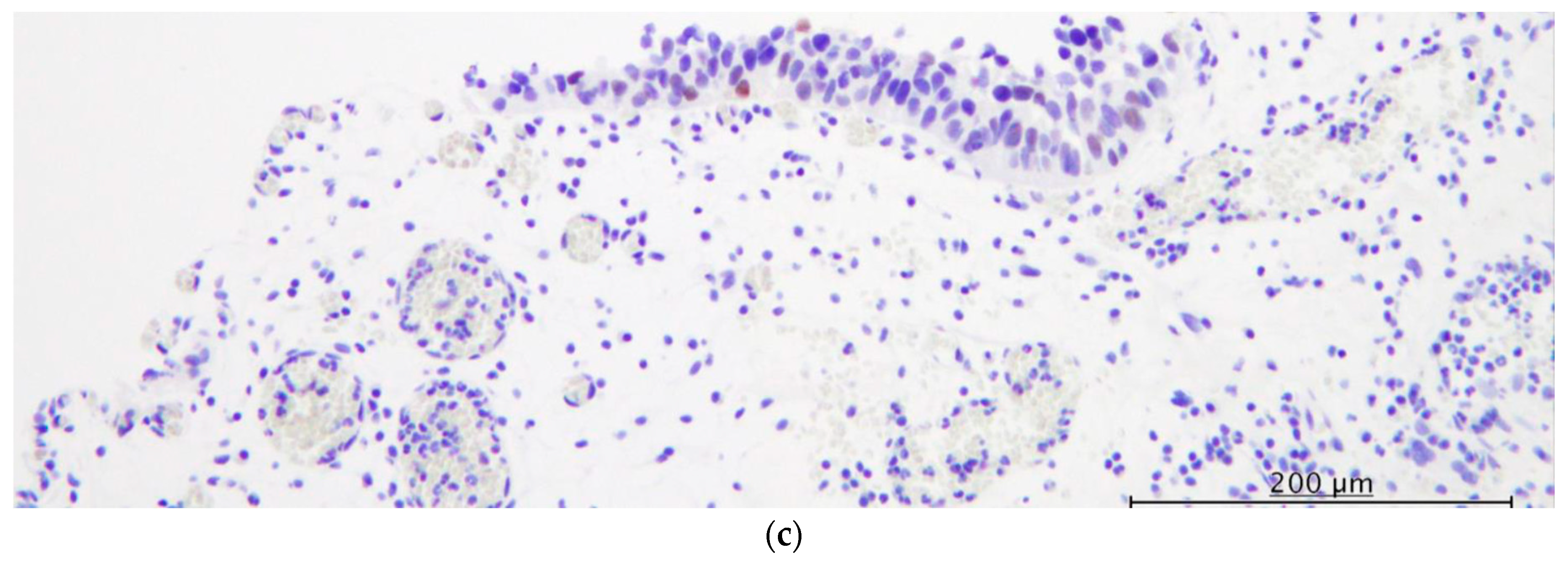 Diagnostics 13 03636 g003b