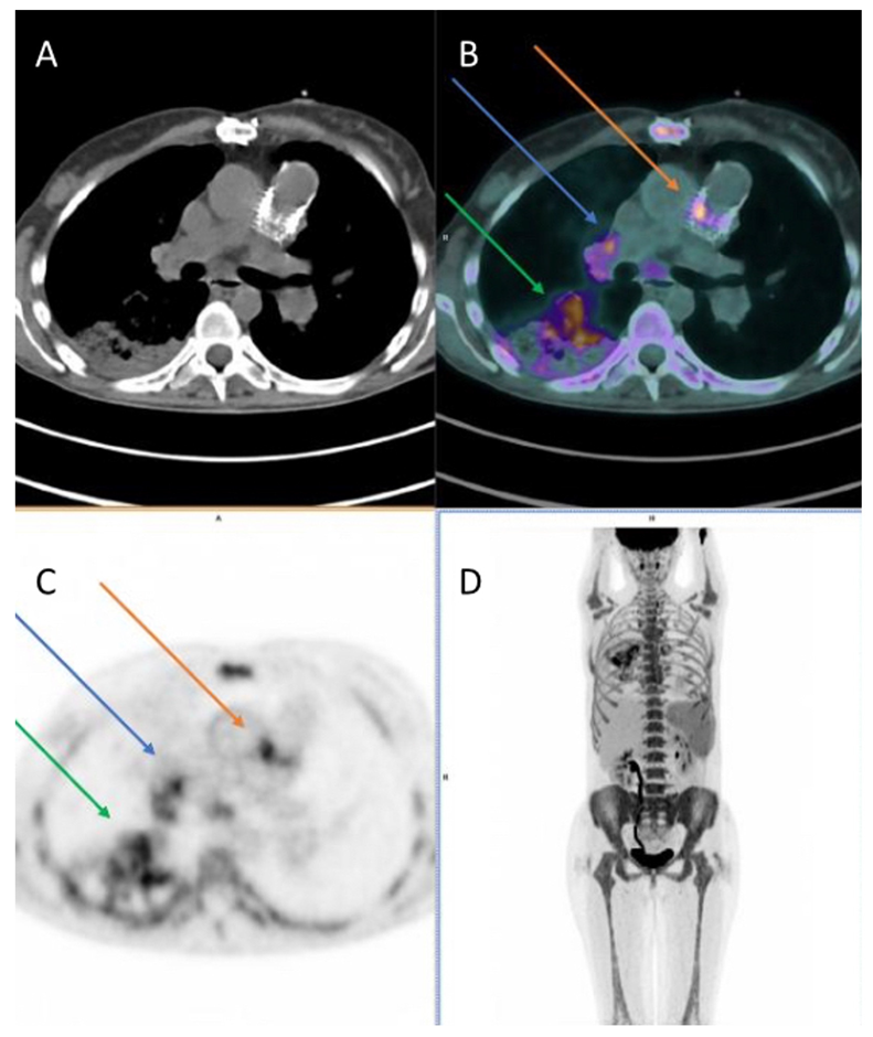 Diagnostics 13 03638 g004