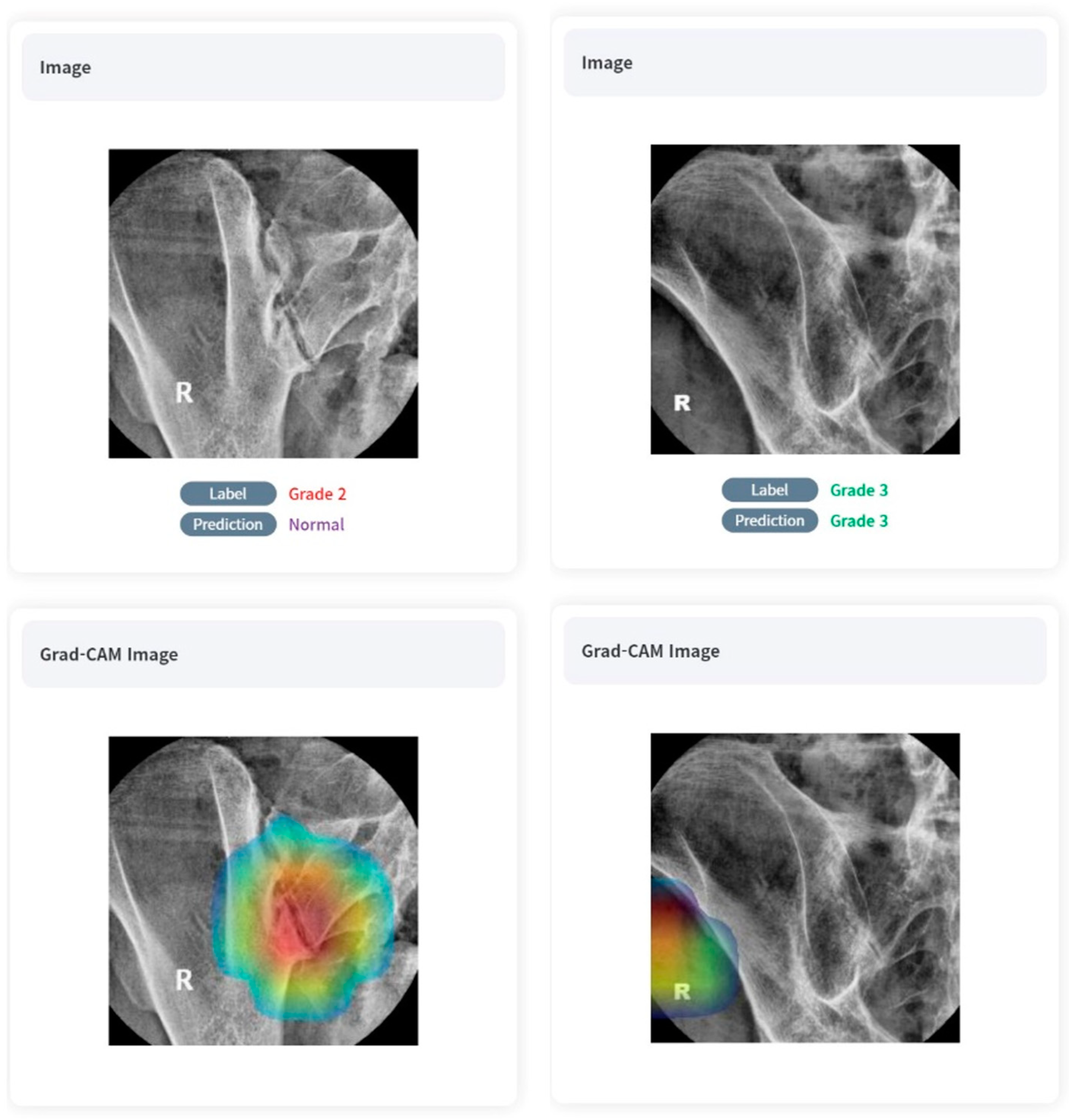 Diagnostics 13 03643 g006