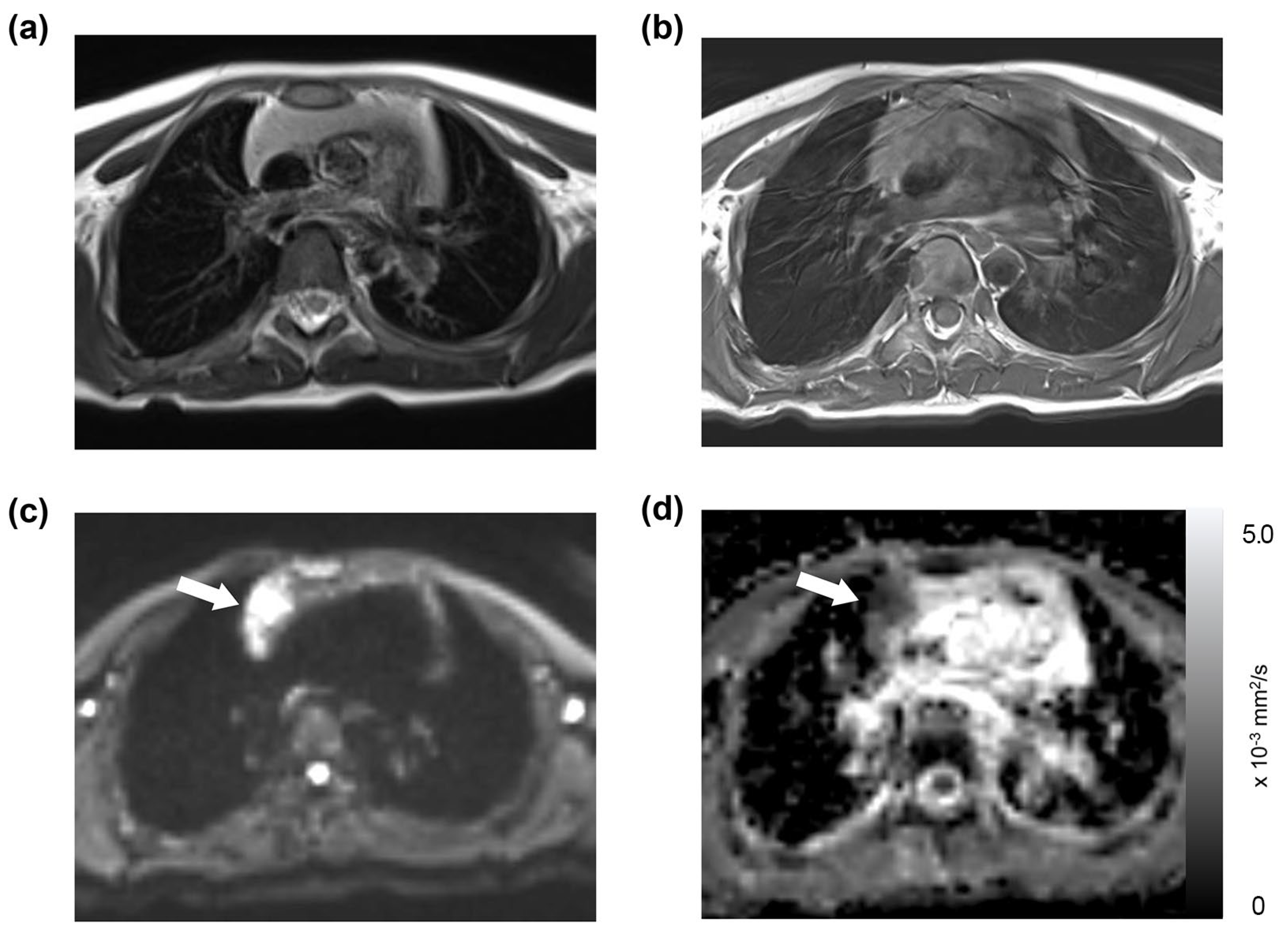 Diagnostics 13 03654 g002