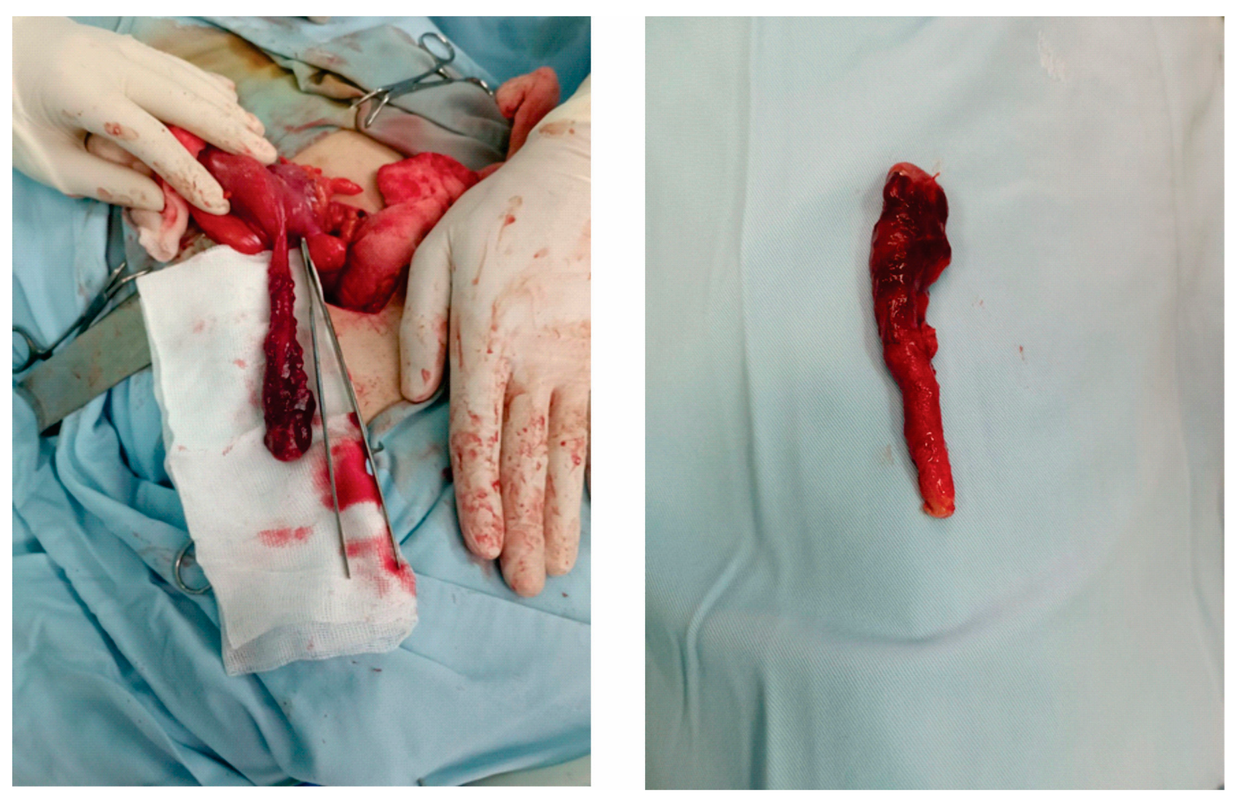 Diagnostics 13 03657 g001 Diagnostics 13 03657 g001