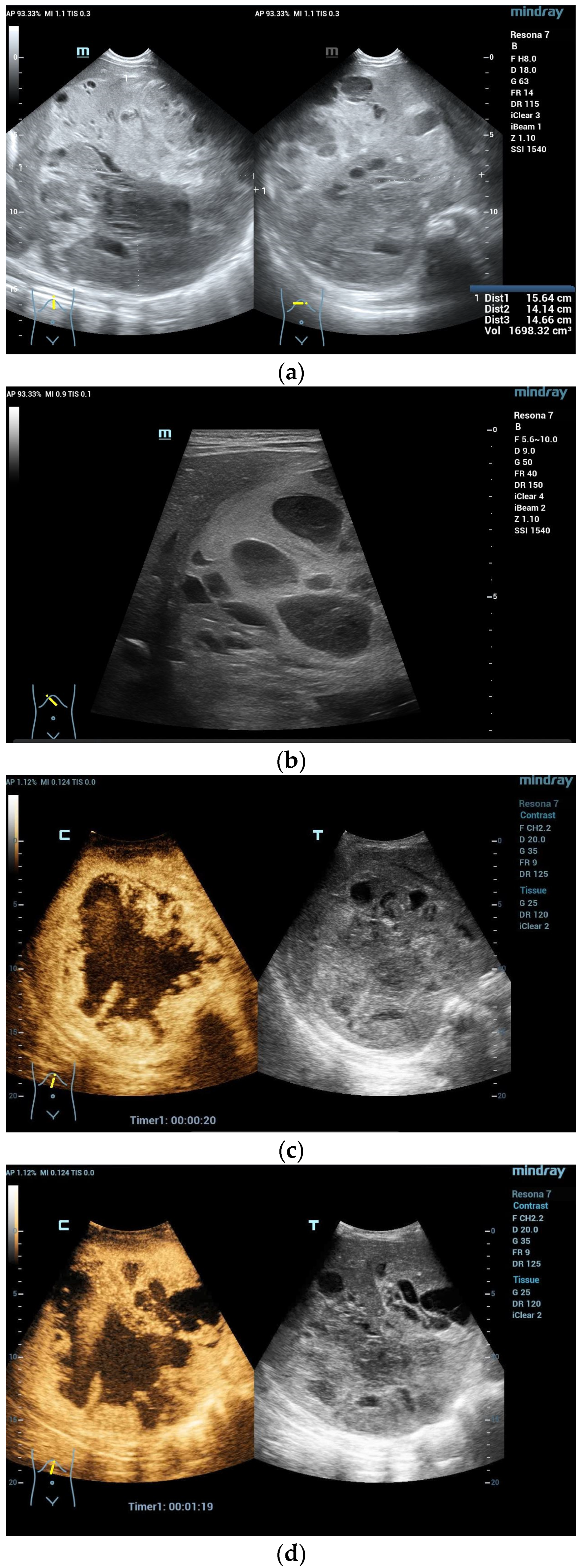 Diagnostics 13 03659 g002a