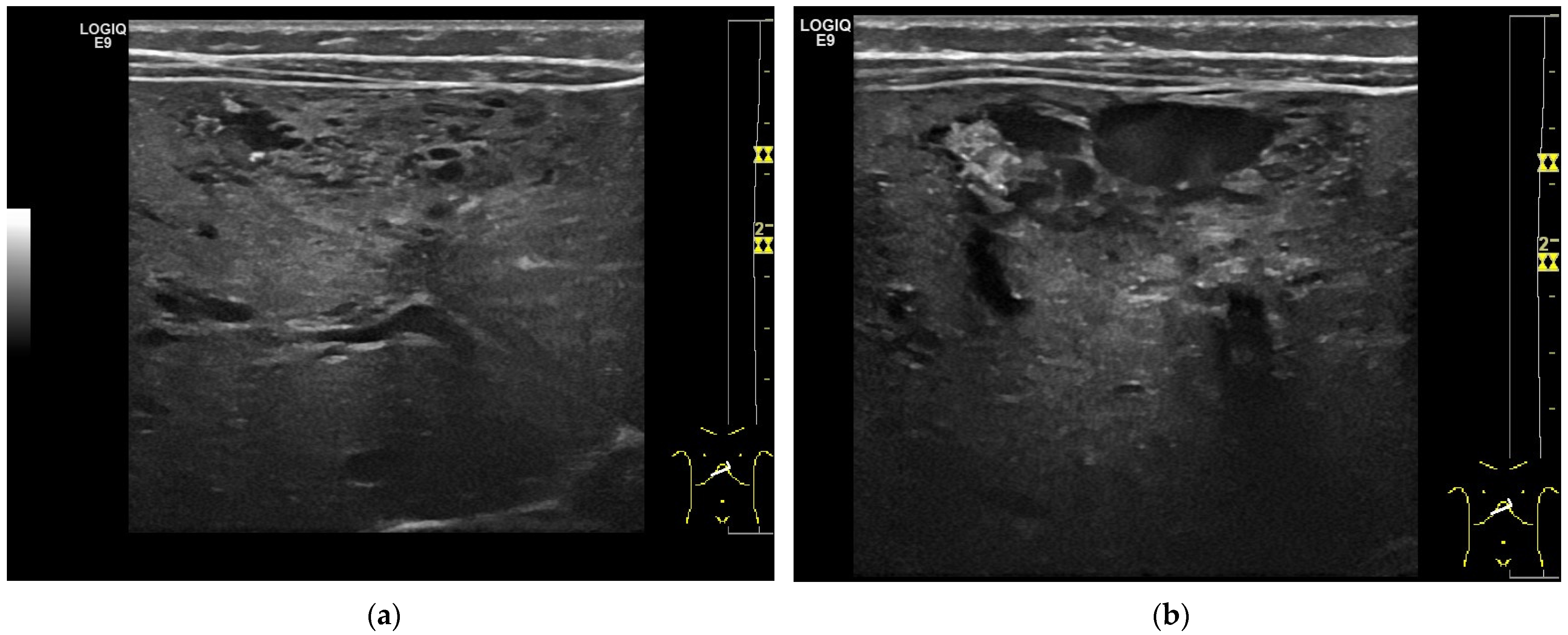 Diagnostics 13 03659 g003a