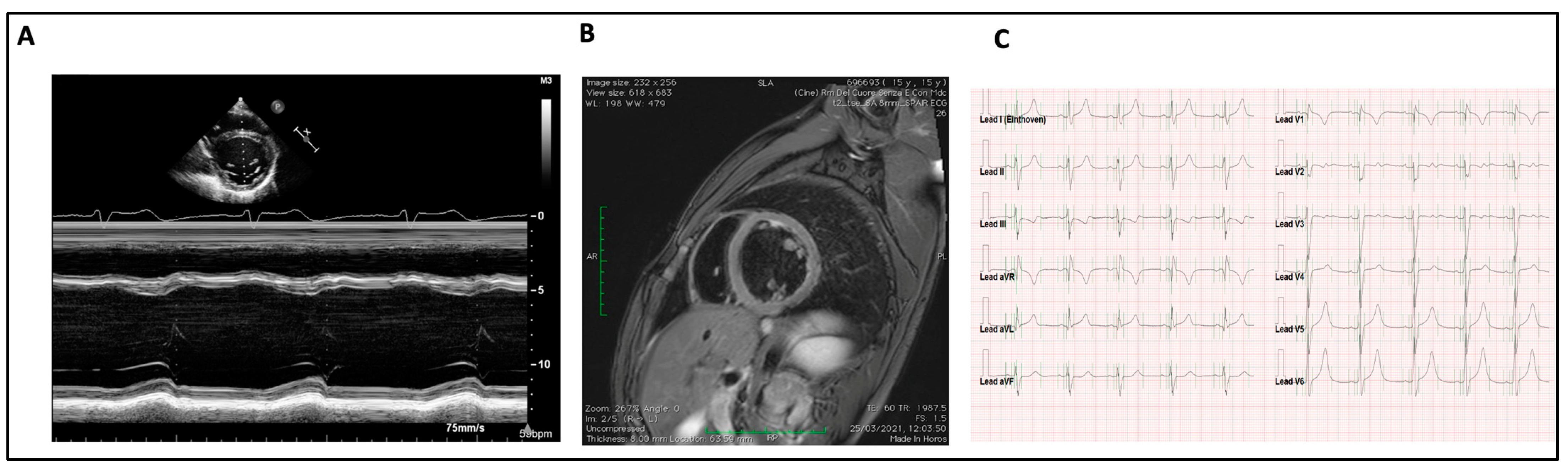 Diagnostics 13 03674 g002