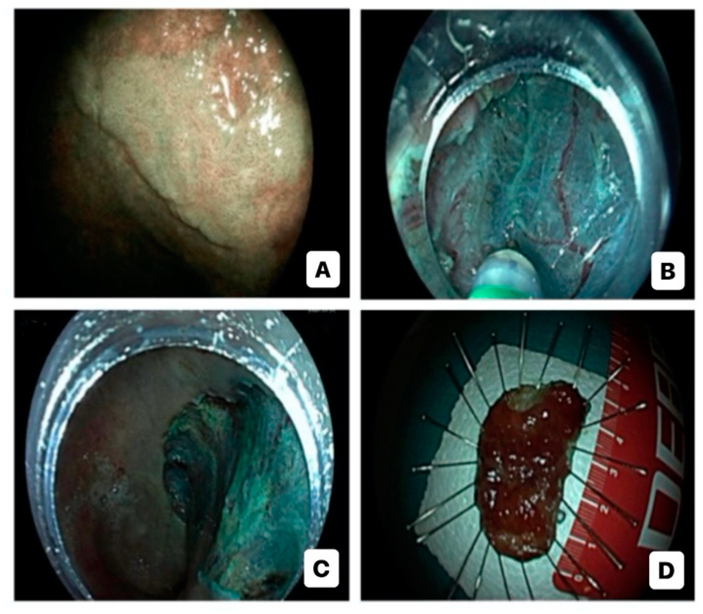 Diagnostics 14 00009 g002