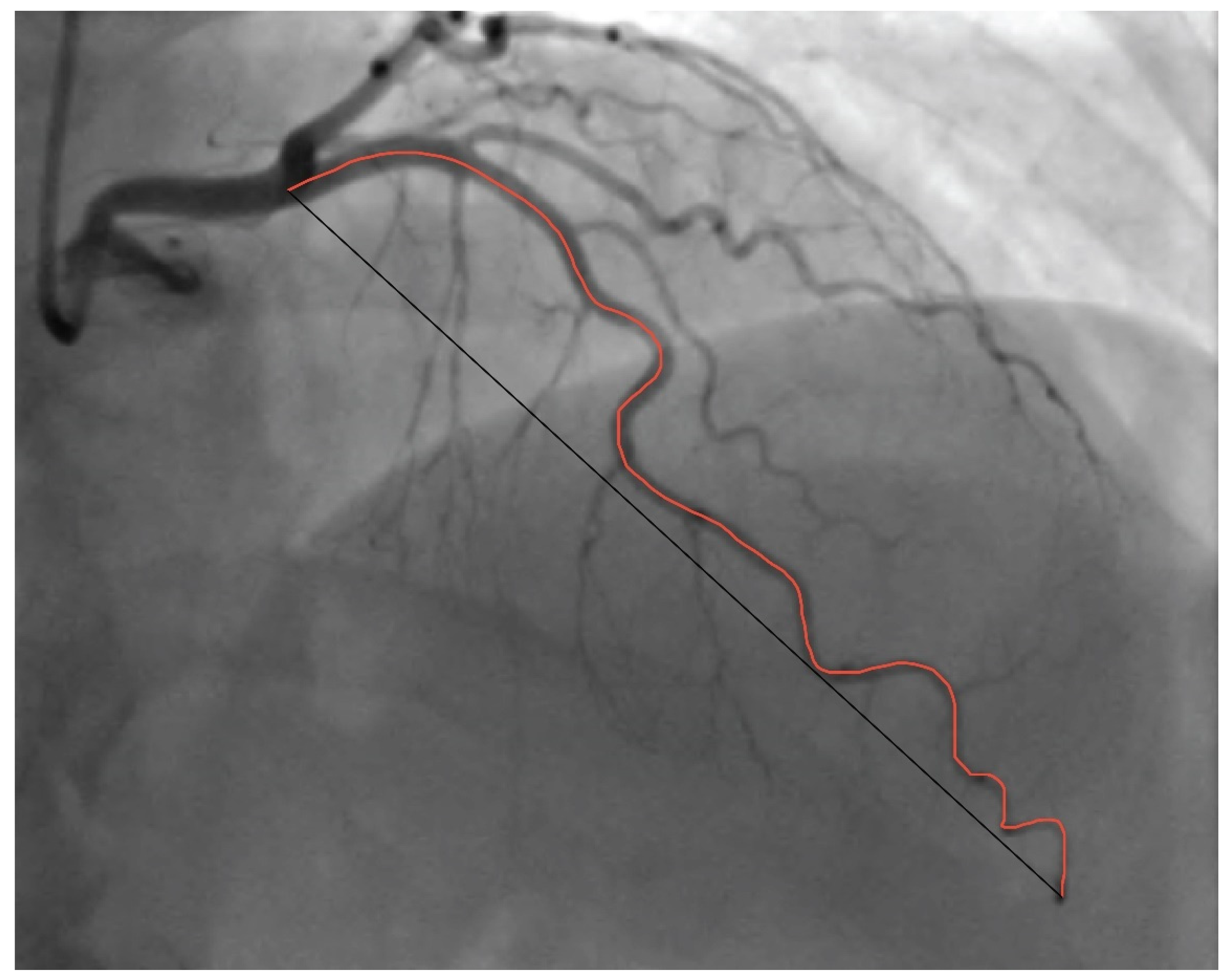 Diagnostics 14 00035 g004