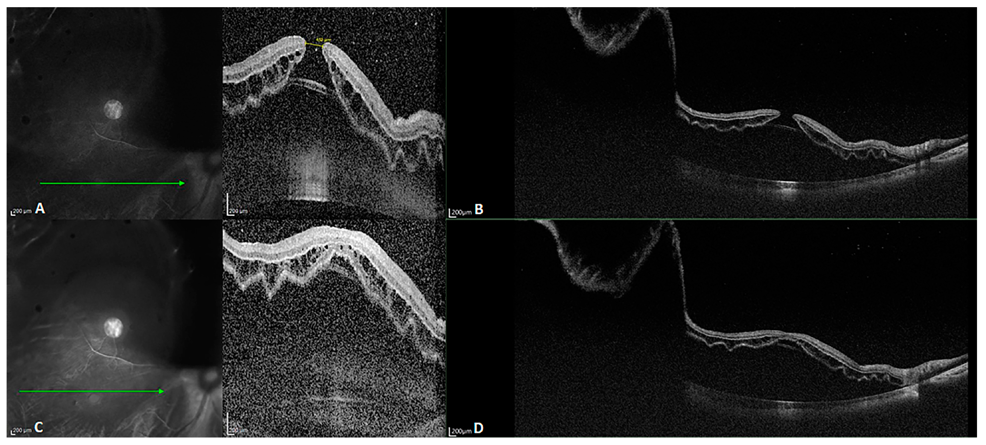 Diagnostics 14 00047 g003