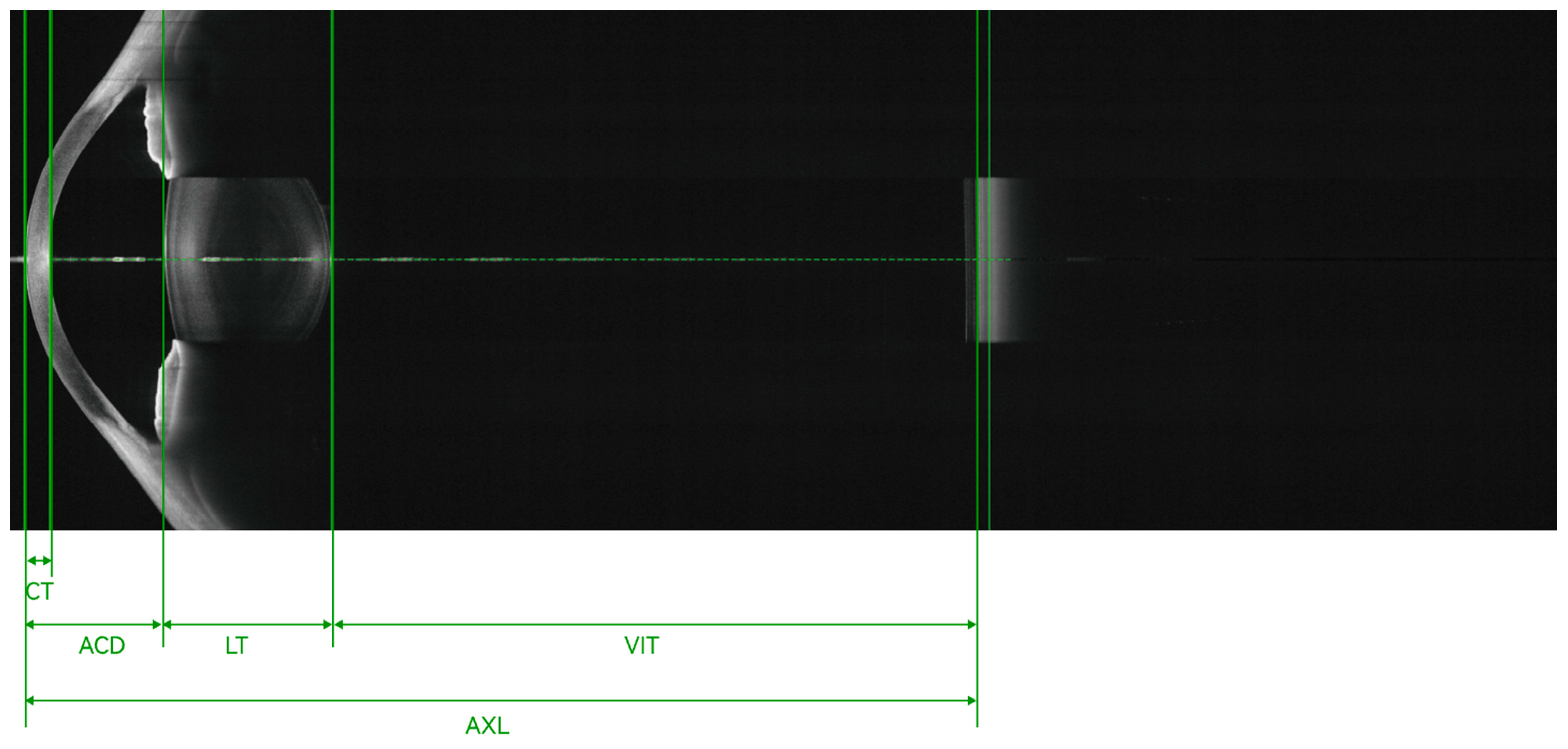 Diagnostics 14 00047 g004