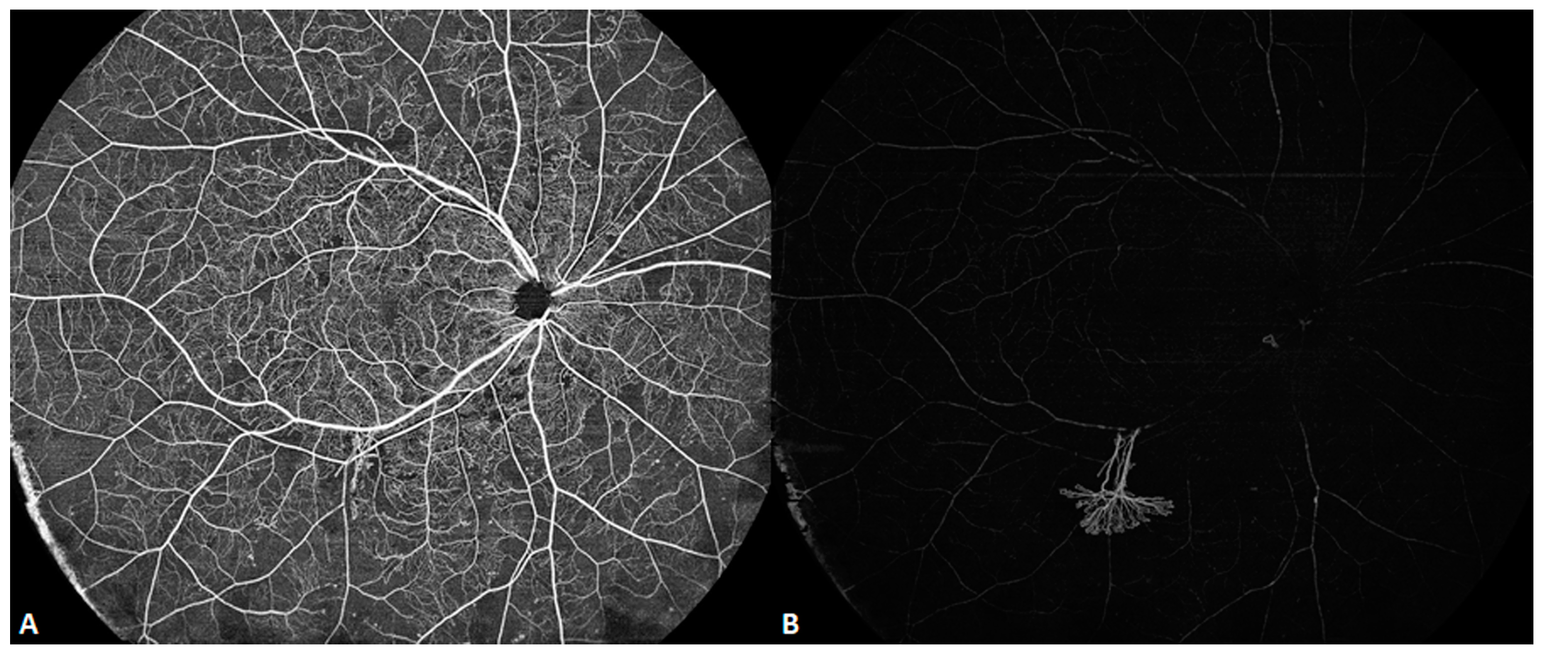 Diagnostics 14 00047 g006