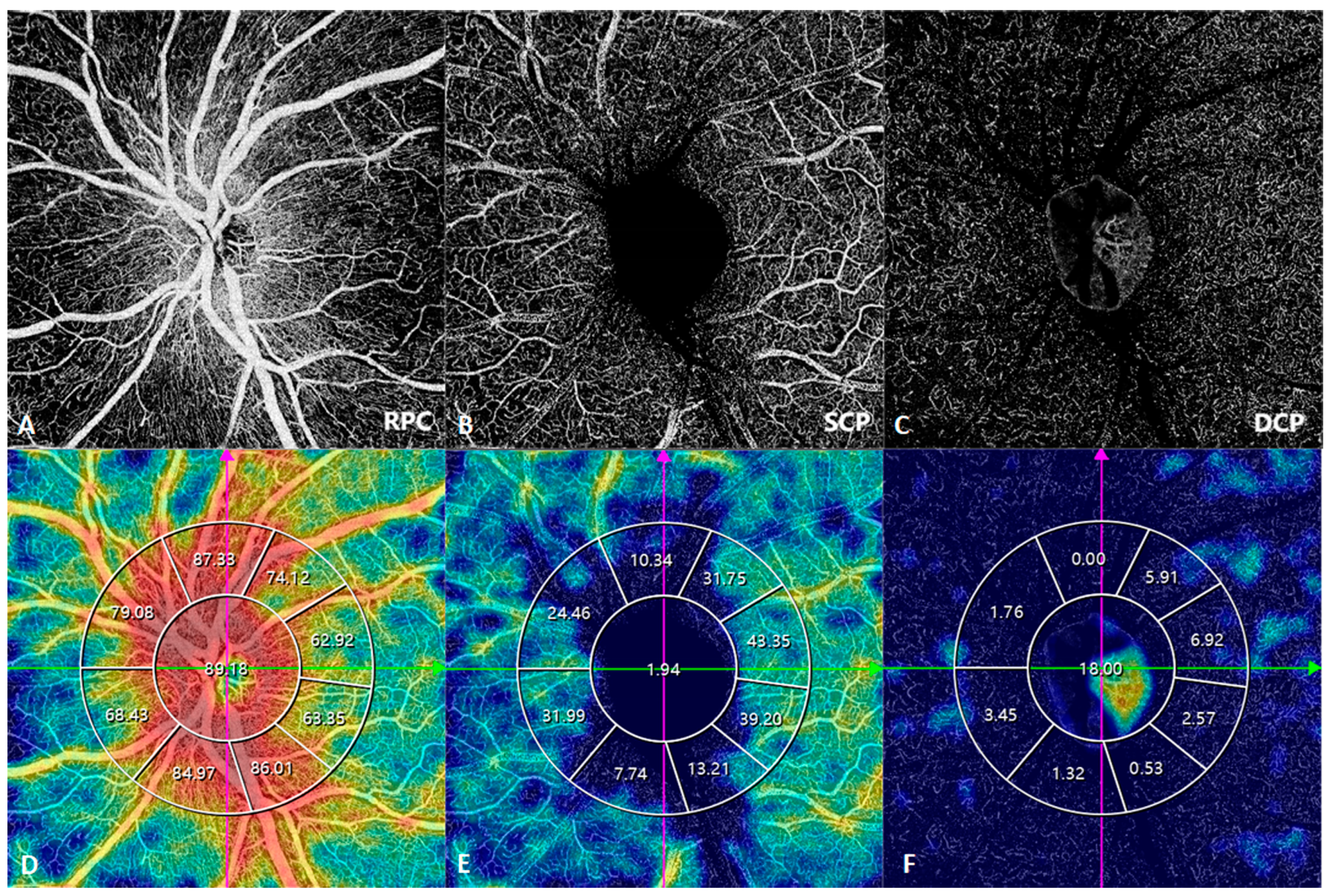 Diagnostics 14 00047 g016