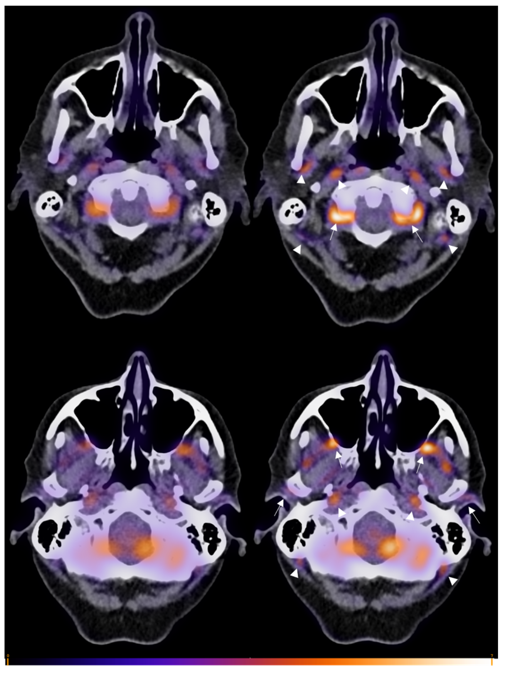 Diagnostics 14 00062 g002