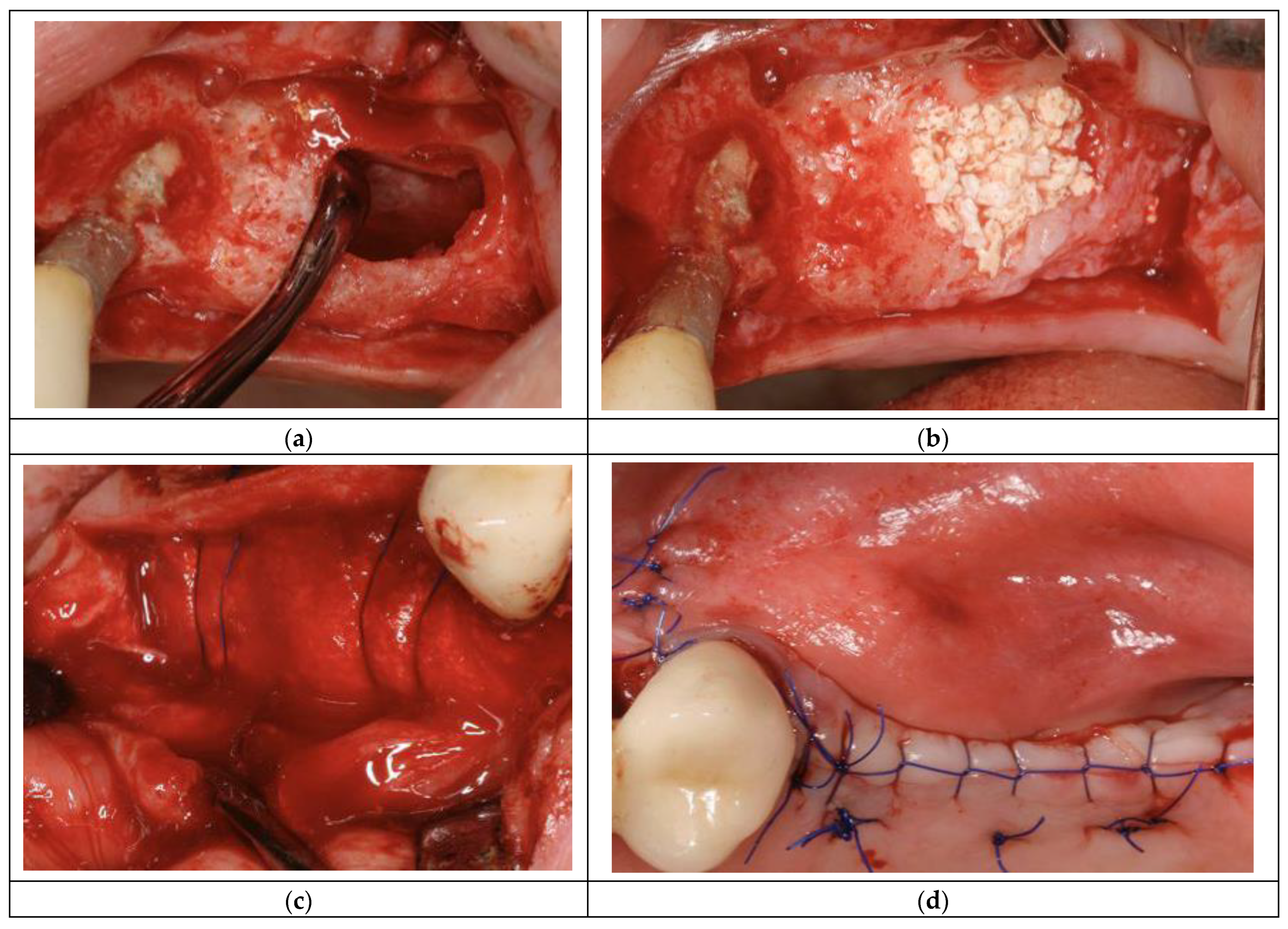 Diagnostics 14 00066 g001 Diagnostics 14 00066 g001