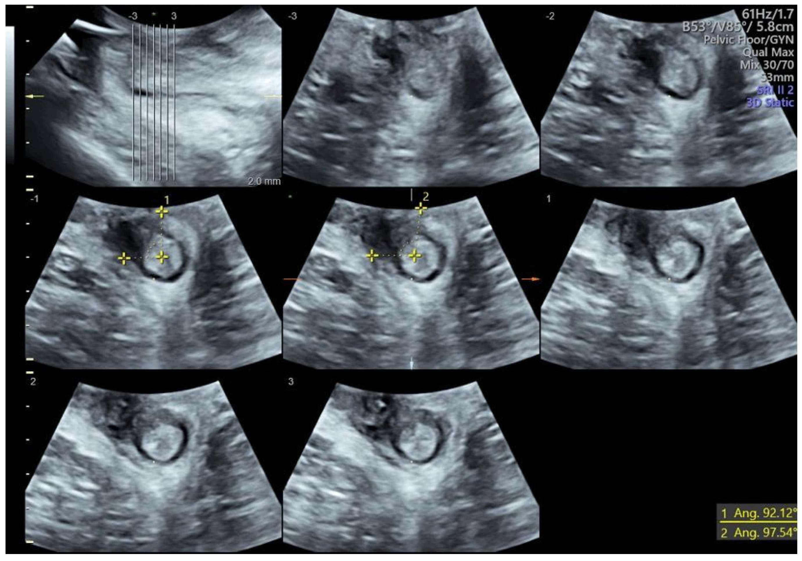 Diagnostics 14 00068 g001