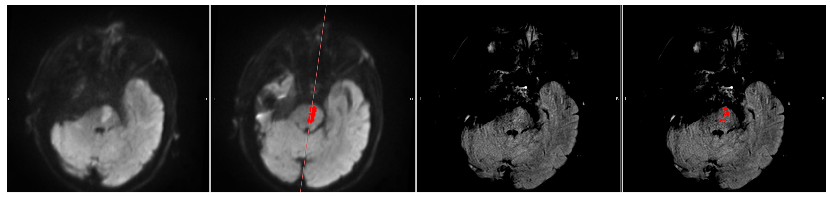 Diagnostics 14 00069 g003