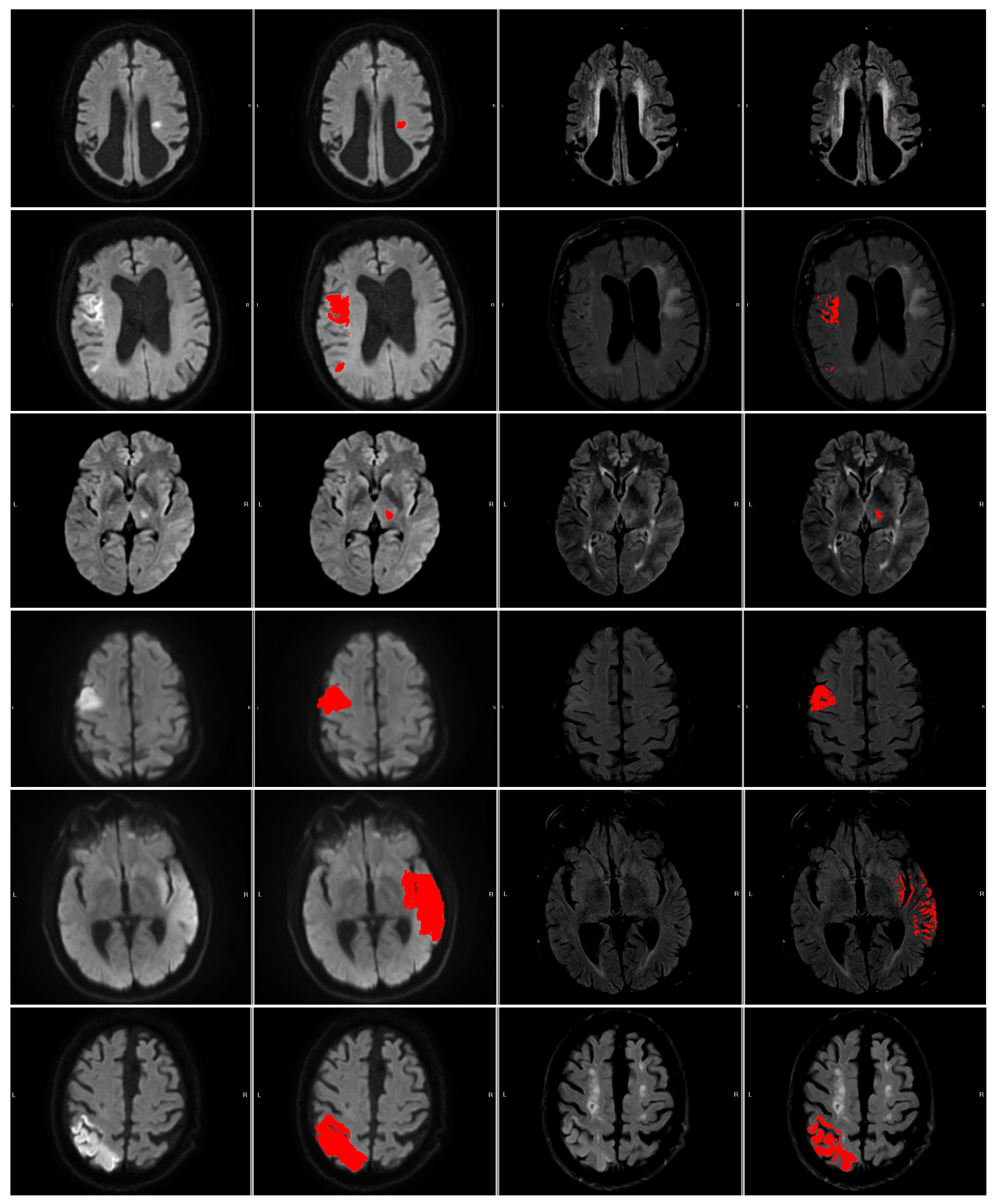 Diagnostics 14 00069 g005