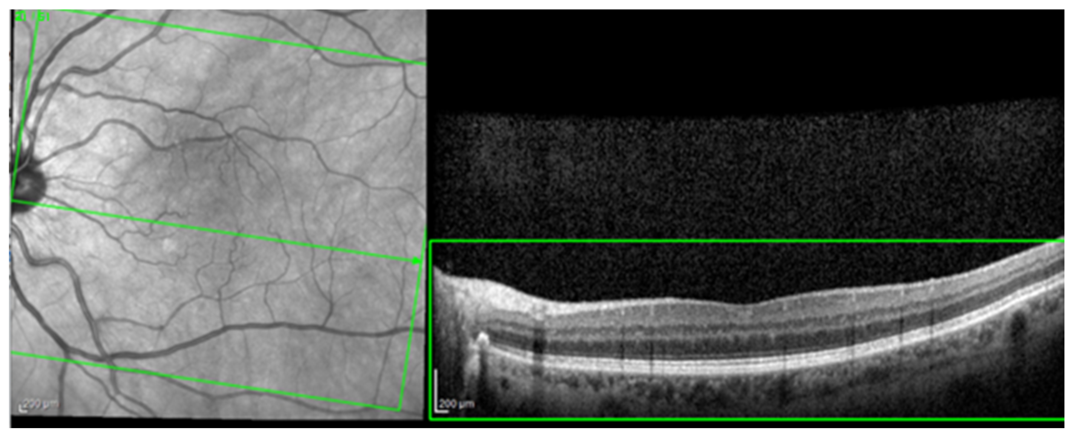 Diagnostics 14 00076 g001