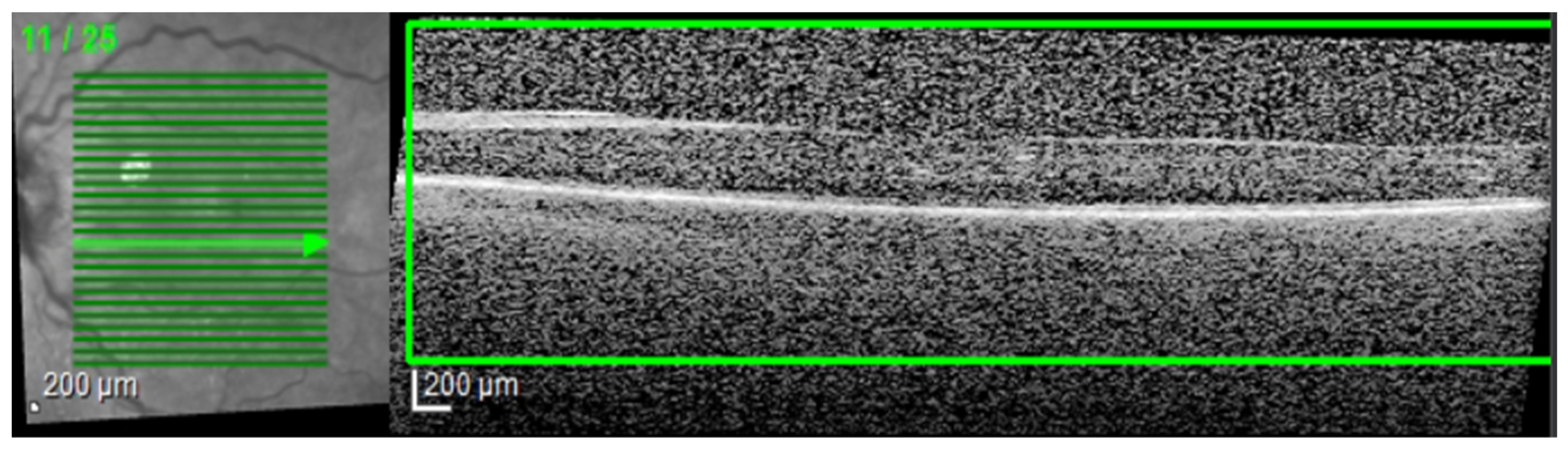 Diagnostics 14 00076 g003