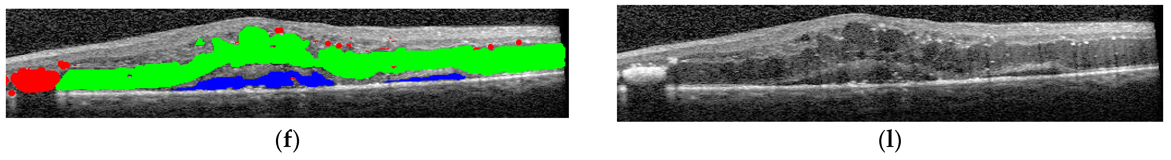 Diagnostics 14 00076 g004b