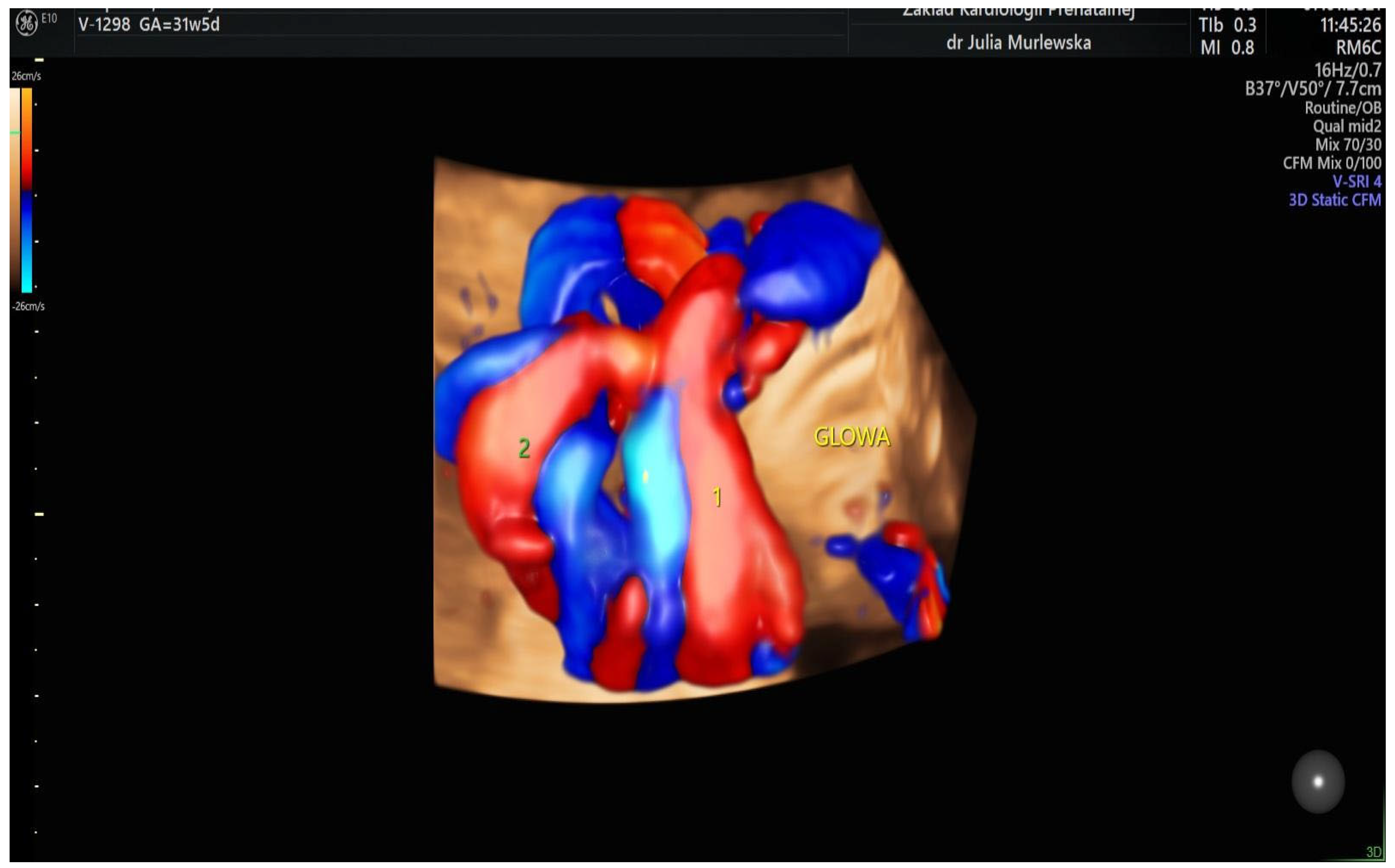 Diagnostics 14 00077 g003