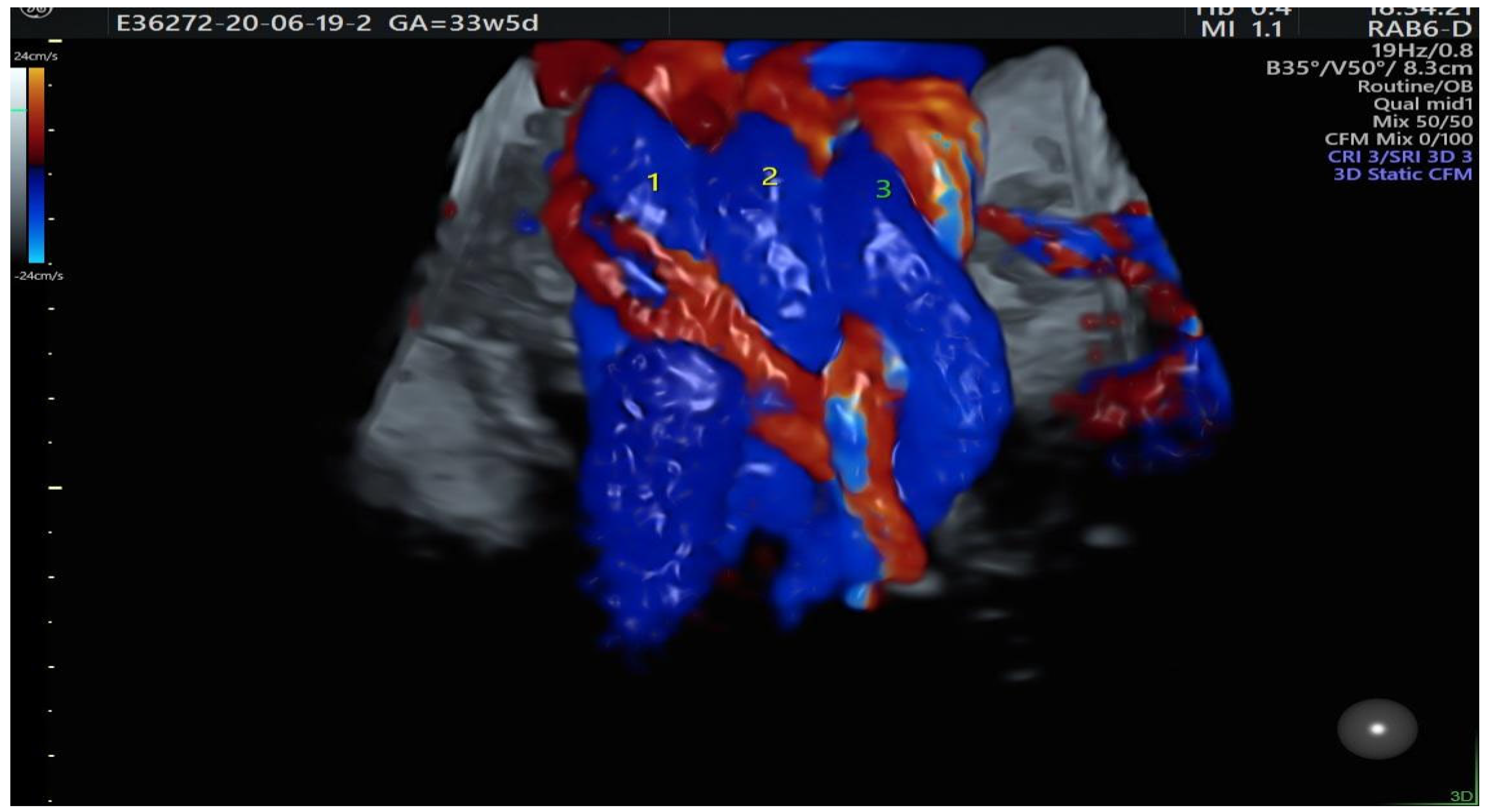 Diagnostics 14 00077 g004