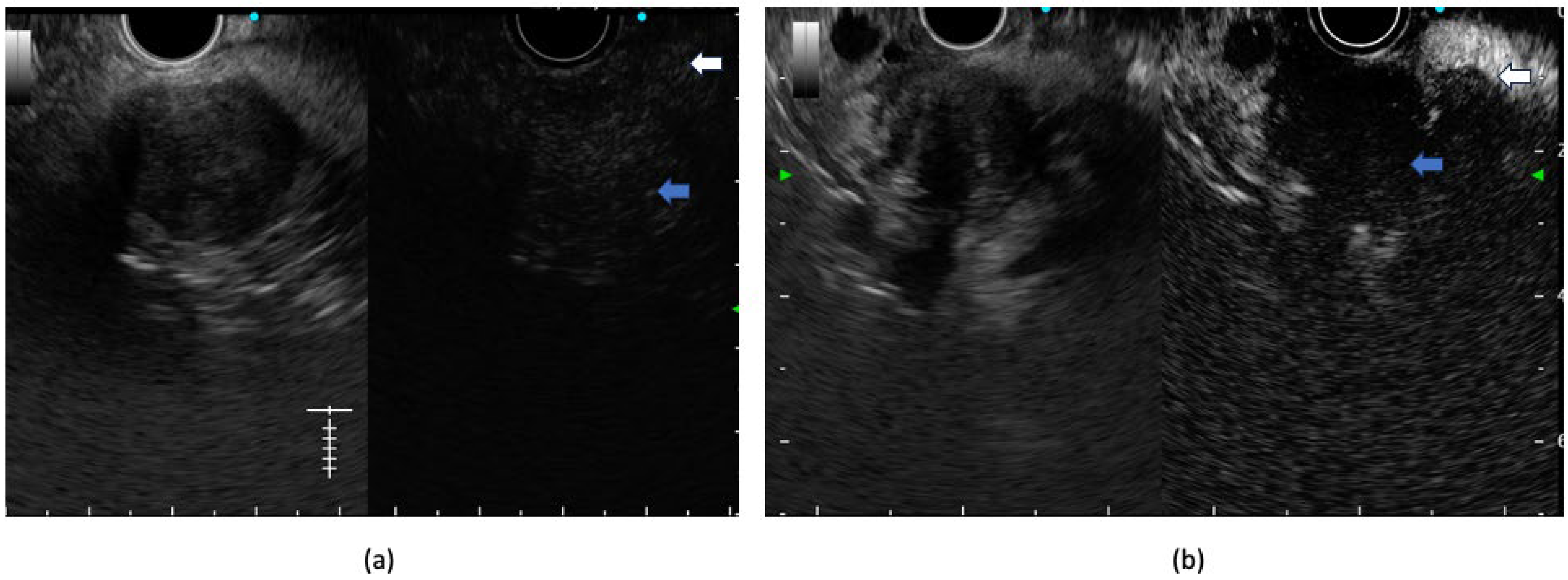 Diagnostics 14 00078 g003