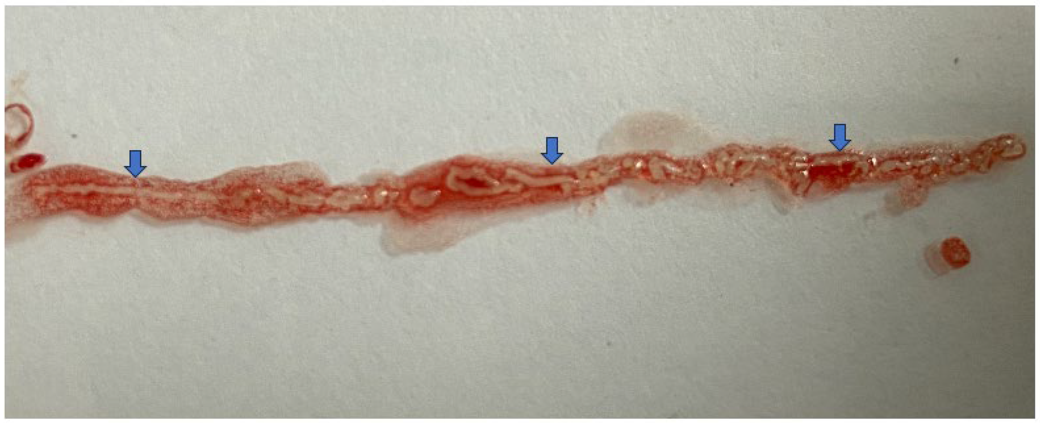 Diagnostics 14 00078 g005