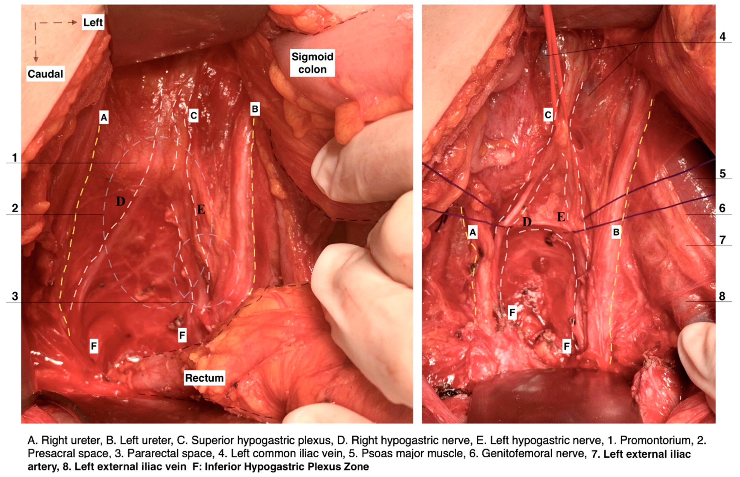 Diagnostics 14 00083 g004