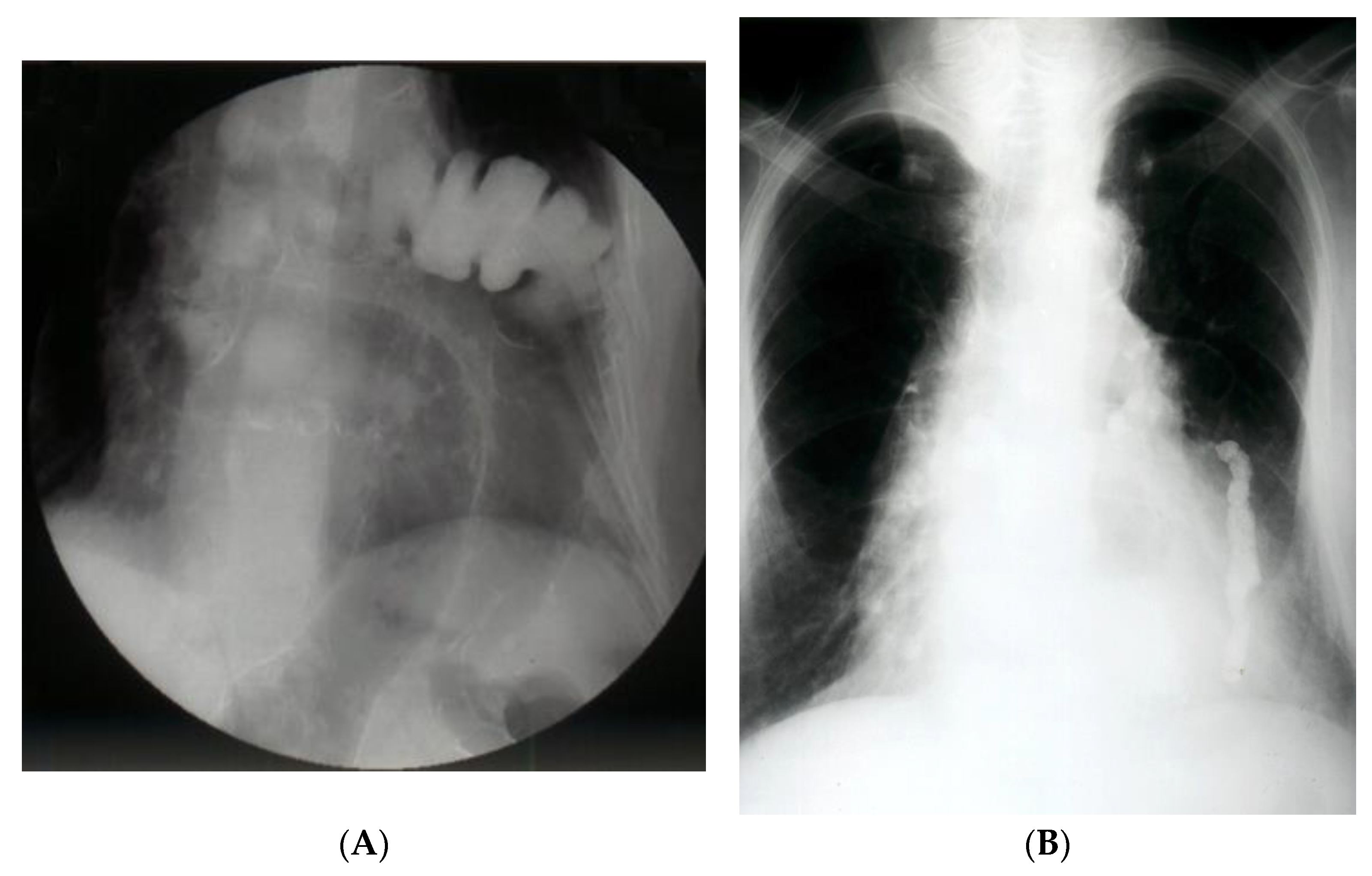 Diagnostics 14 00085 g002