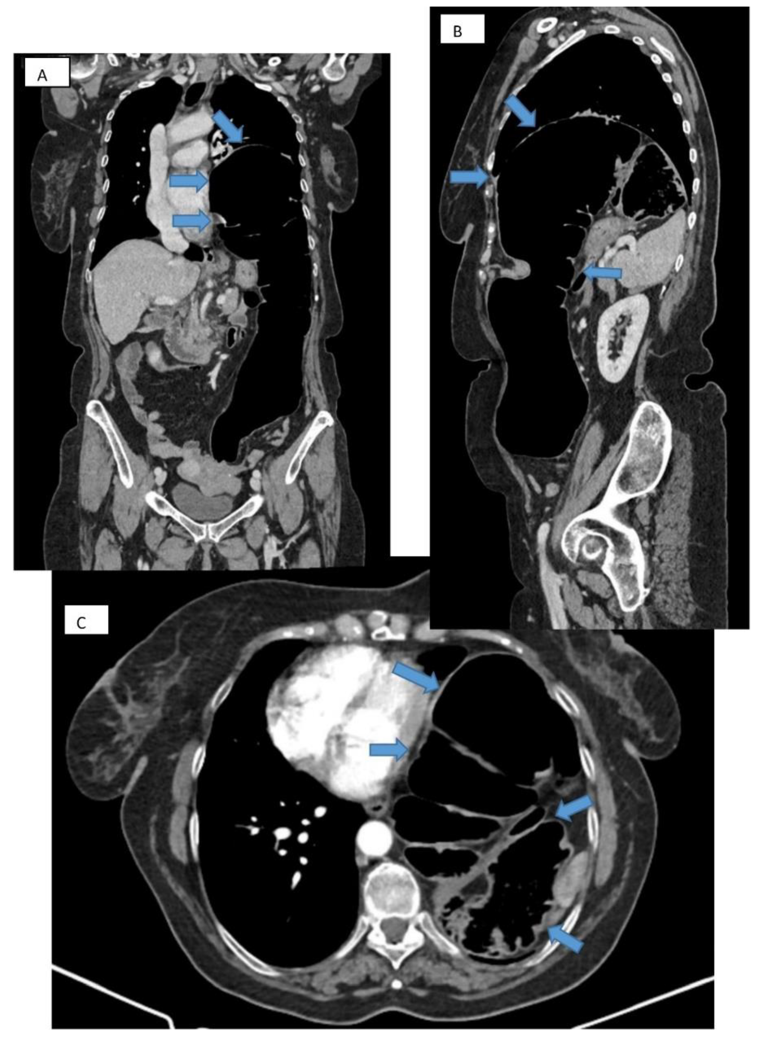 Diagnostics 14 00085 g003