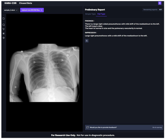 Validation of a Deep Learning Chest X-ray Interpretation Model 