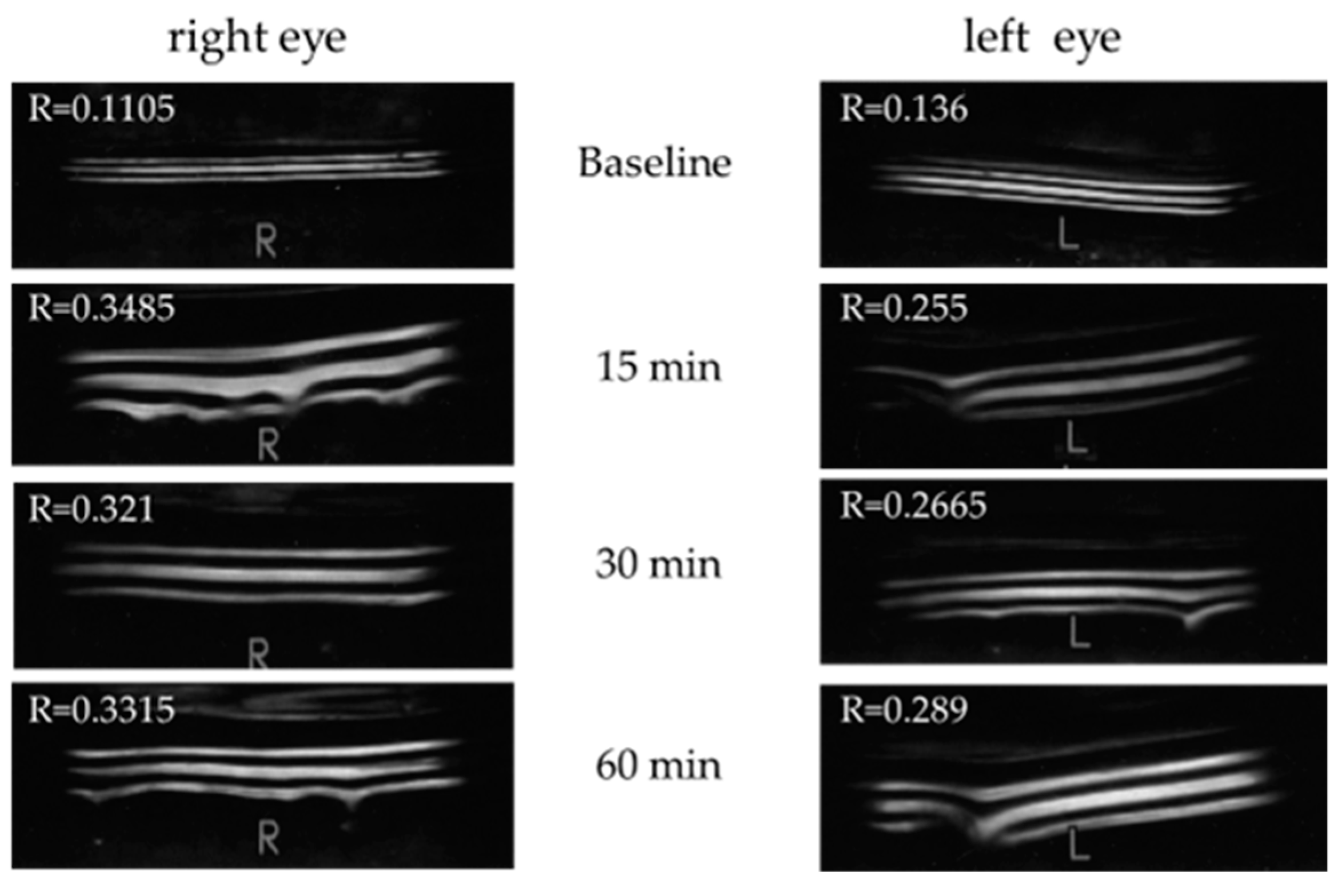 Diagnostics 14 00091 g005 Diagnostics 14 00091 g005
