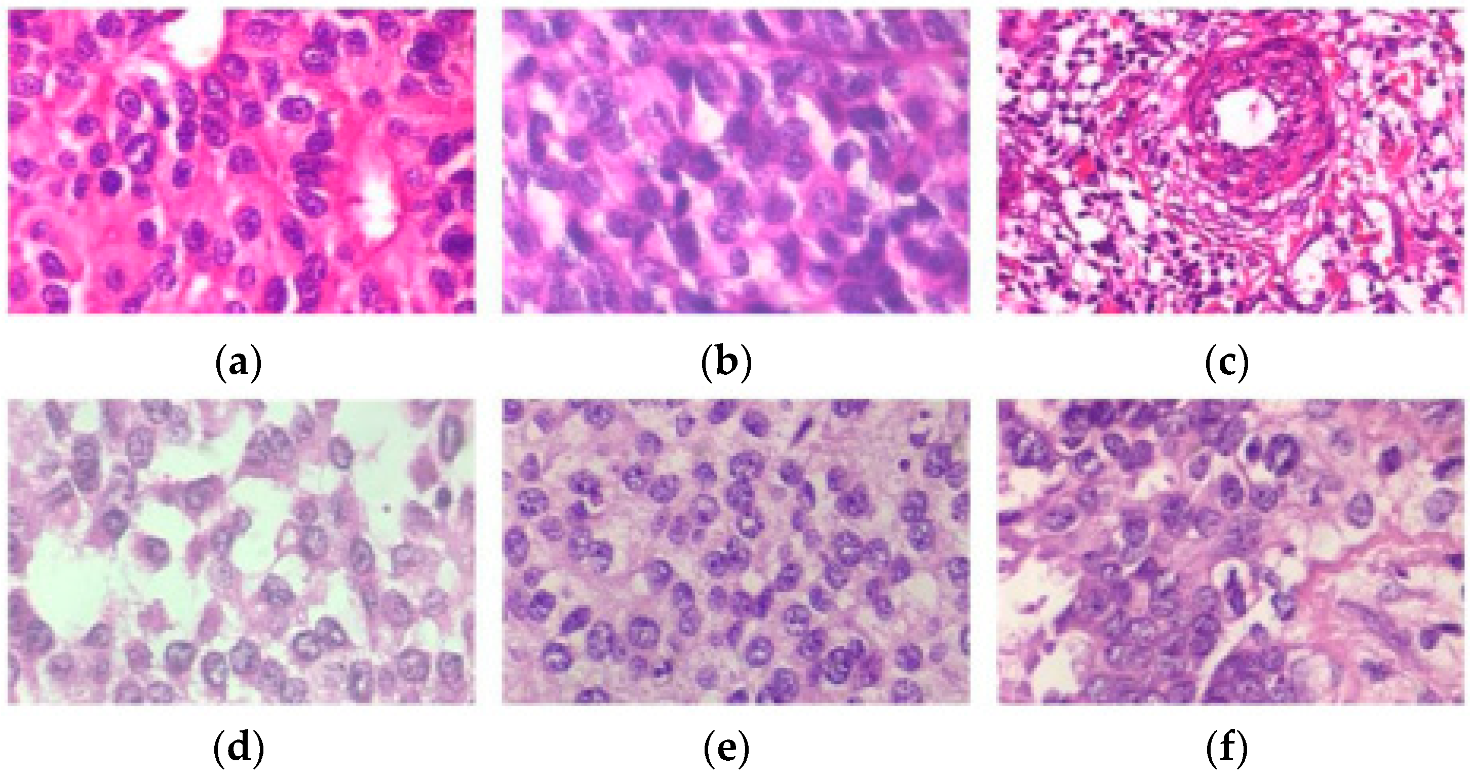 Diagnostics 14 00095 g002