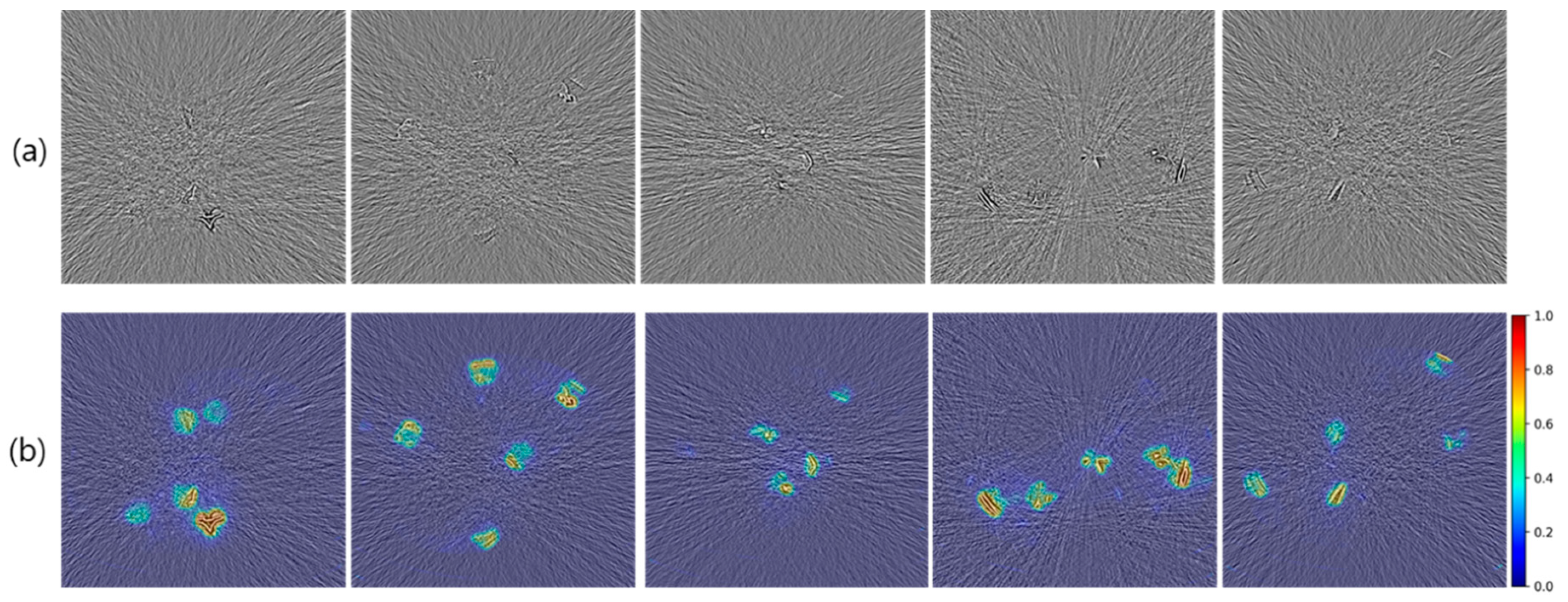 Diagnostics 14 00096 g004