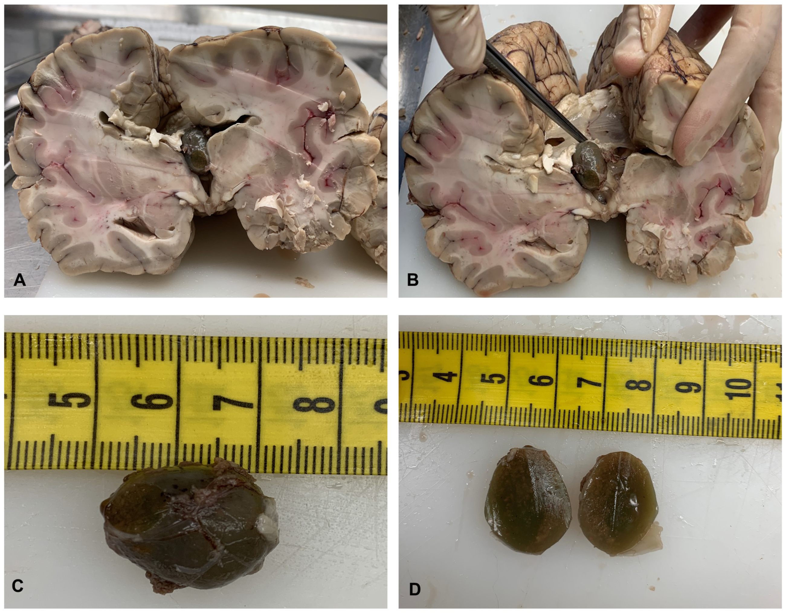 Diagnostics 14 00100 g001 Diagnostics 14 00100 g001