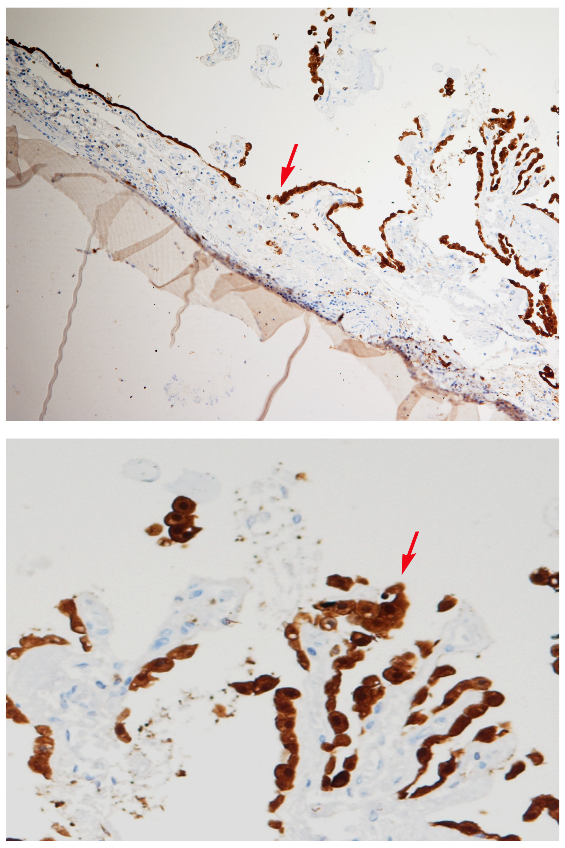 Diagnostics 14 00100 g003 Diagnostics 14 00100 g003