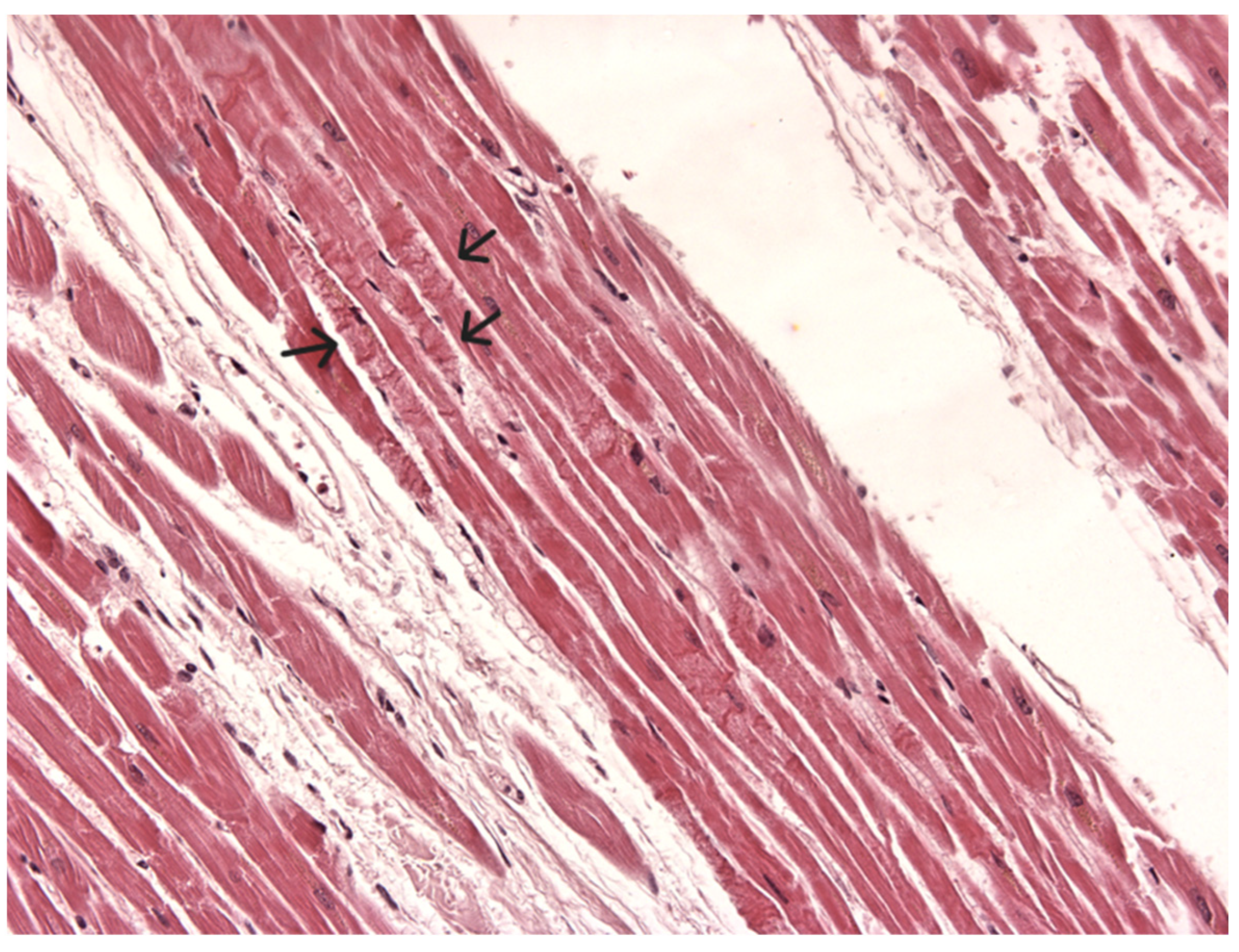 Diagnostics 14 00100 g004 Diagnostics 14 00100 g004