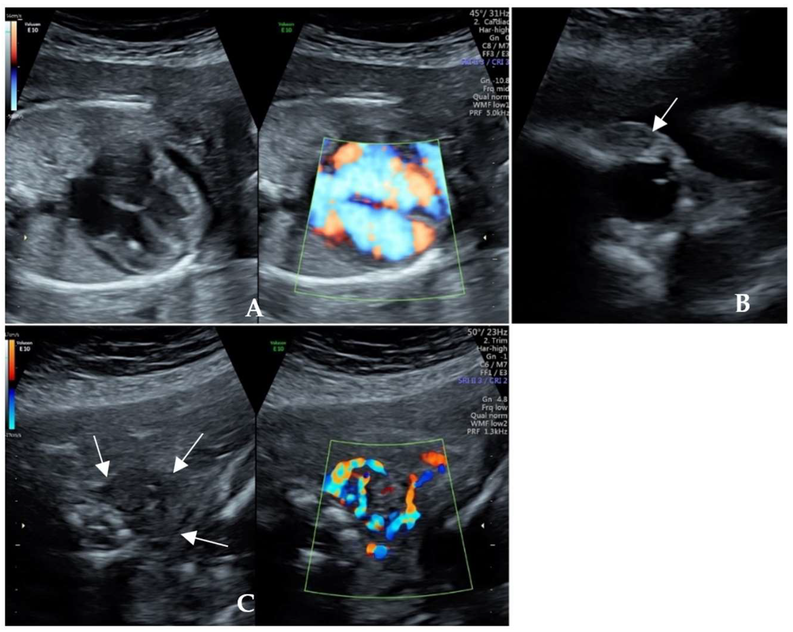 Diagnostics 14 00102 g001