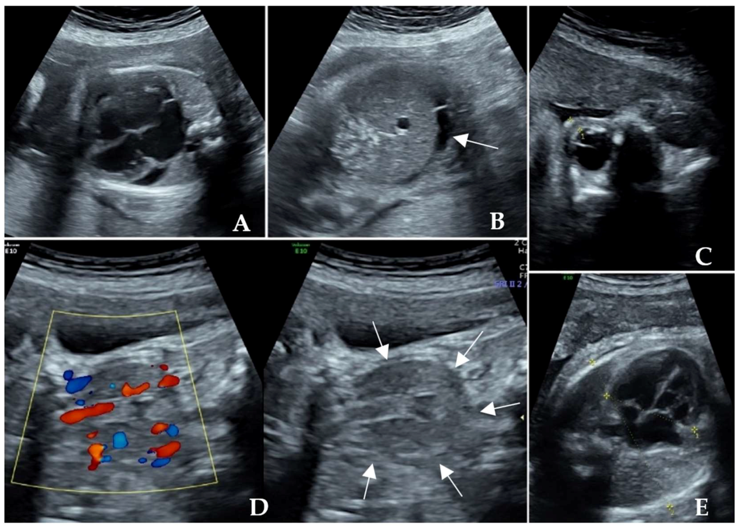 Diagnostics 14 00102 g002