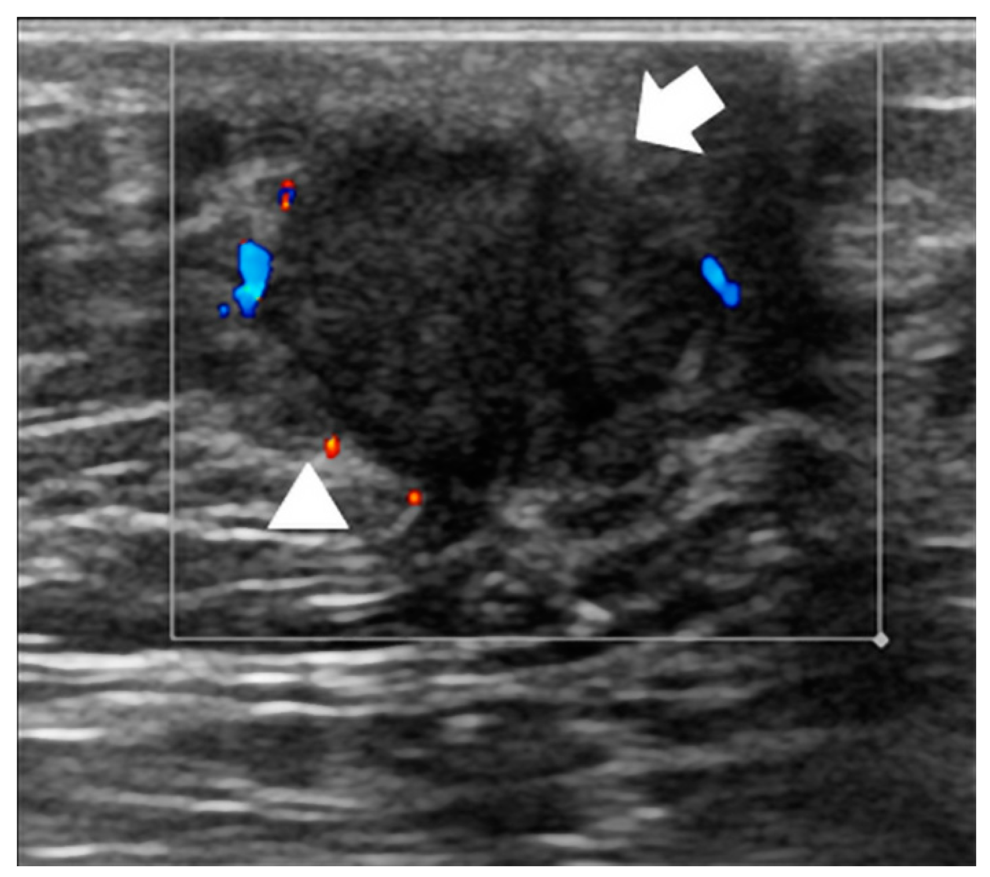 Diagnostics 14 00104 g008