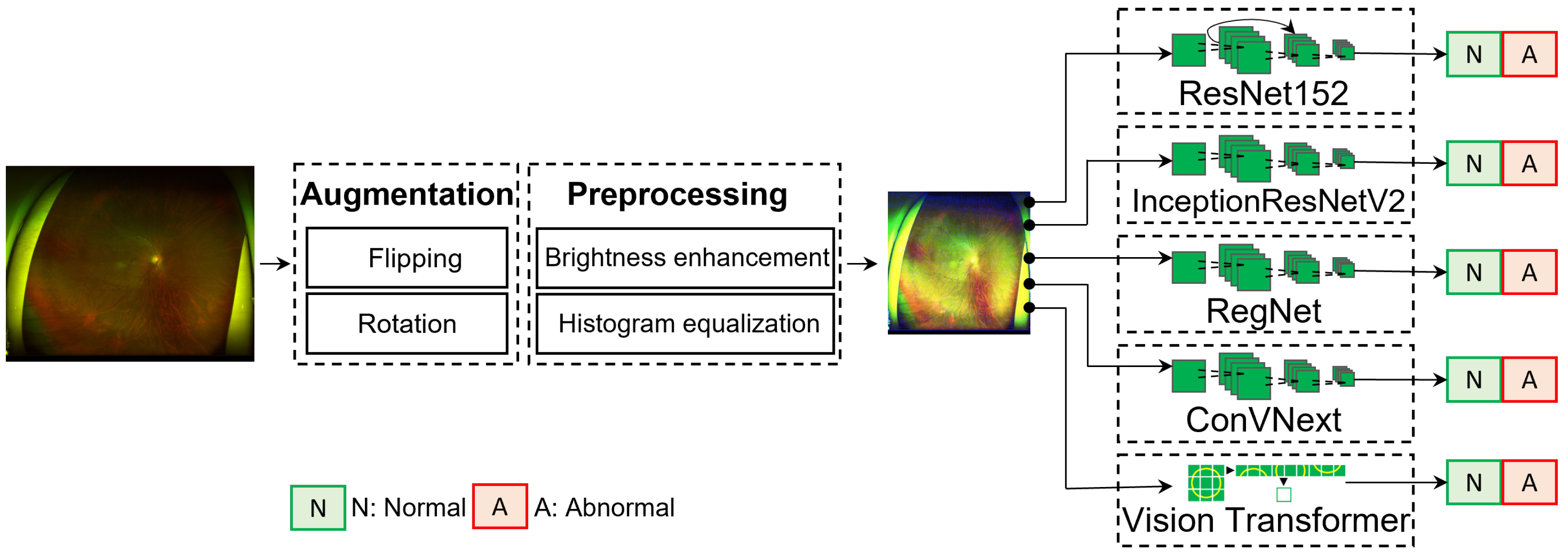Diagnostics | Free Full-Text | Retinal Disease Diagnosis Using Deep ...